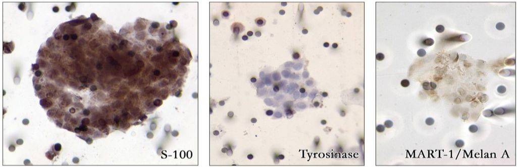 Cancers 06 00323 g002 1024