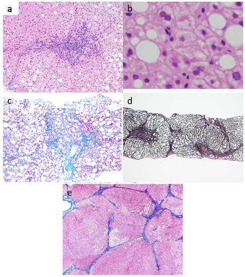 Cancers 06 01220 g001 550