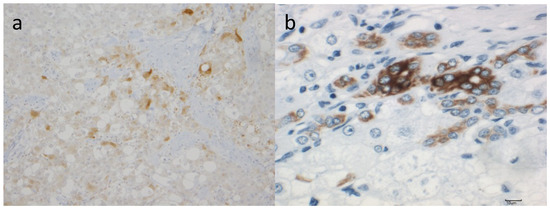 Cancers 06 01220 g003 550