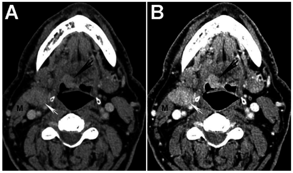 Cancers 07 00886 g002 1024