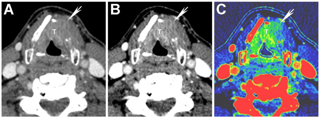Cancers 07 00886 g003 1024
