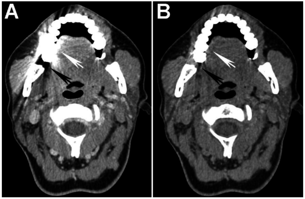 Cancers 07 00886 g006 1024