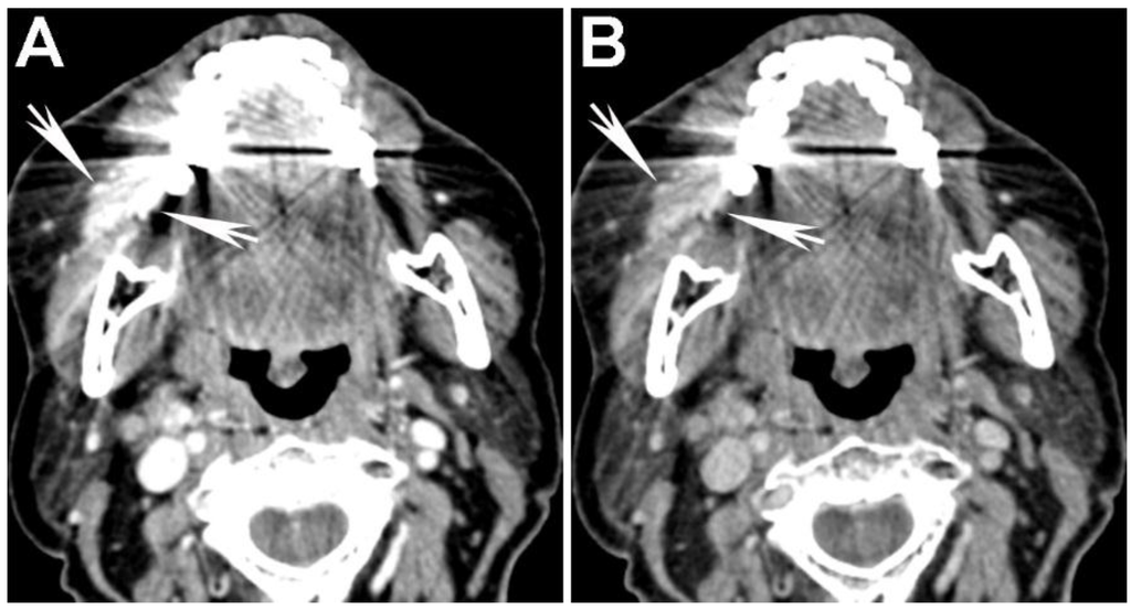 Cancers 07 00886 g007 1024