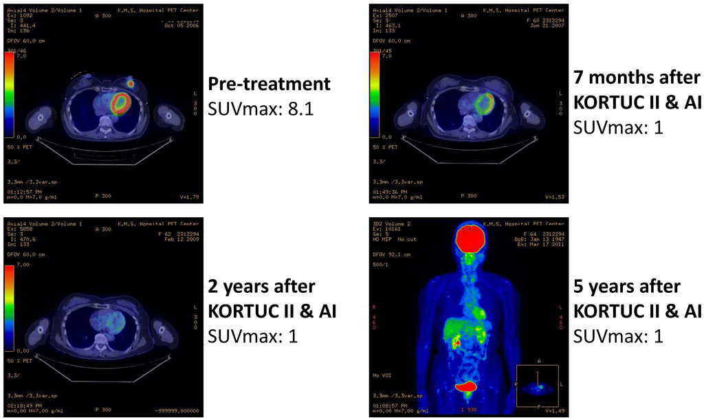 Cancers 07 00891 g004 1024