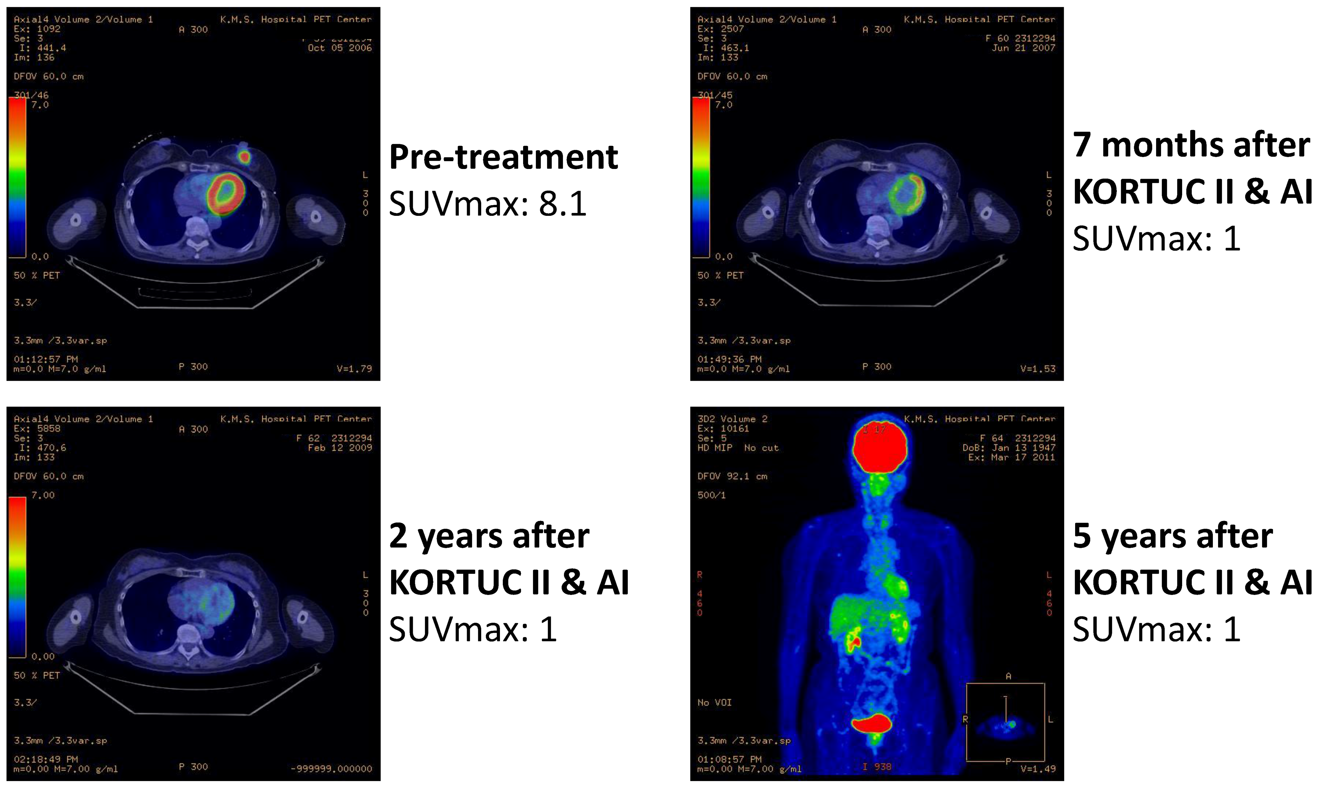 Cancers 07 00891 g004