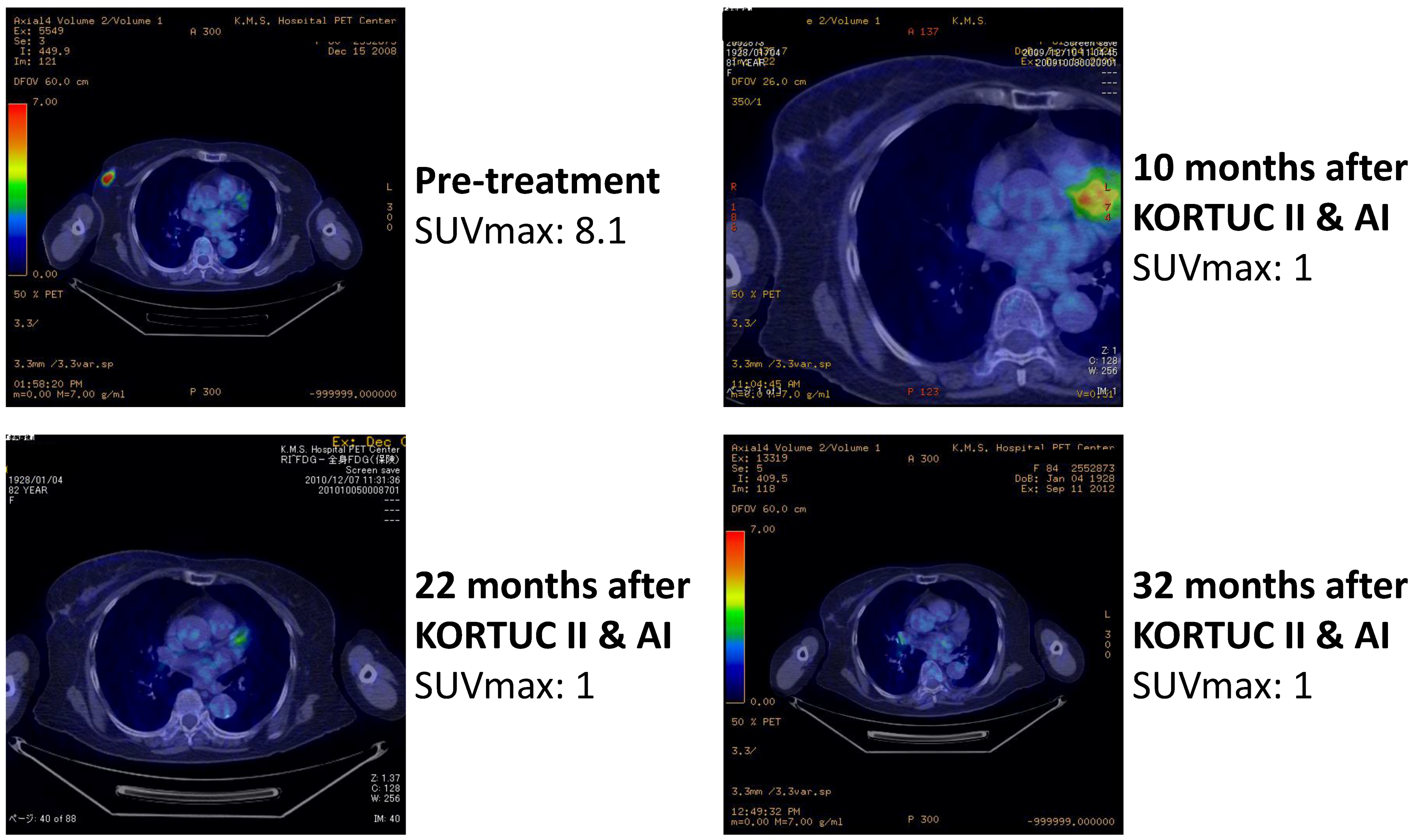 Cancers 07 00891 g005