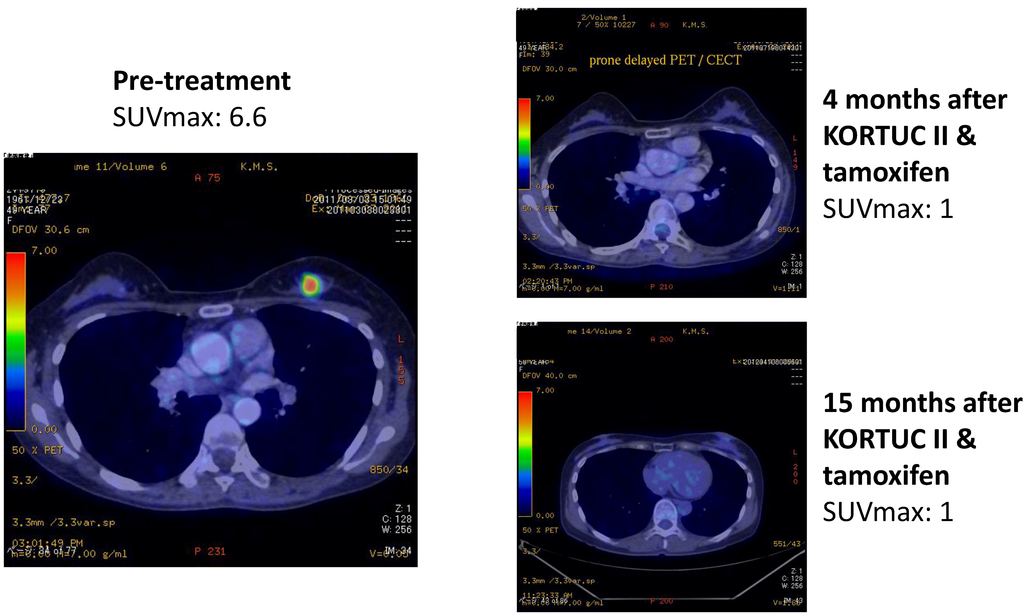 Cancers 07 00891 g006 1024