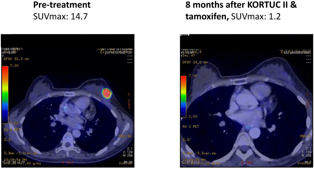 Cancers 07 00891 g007 1024
