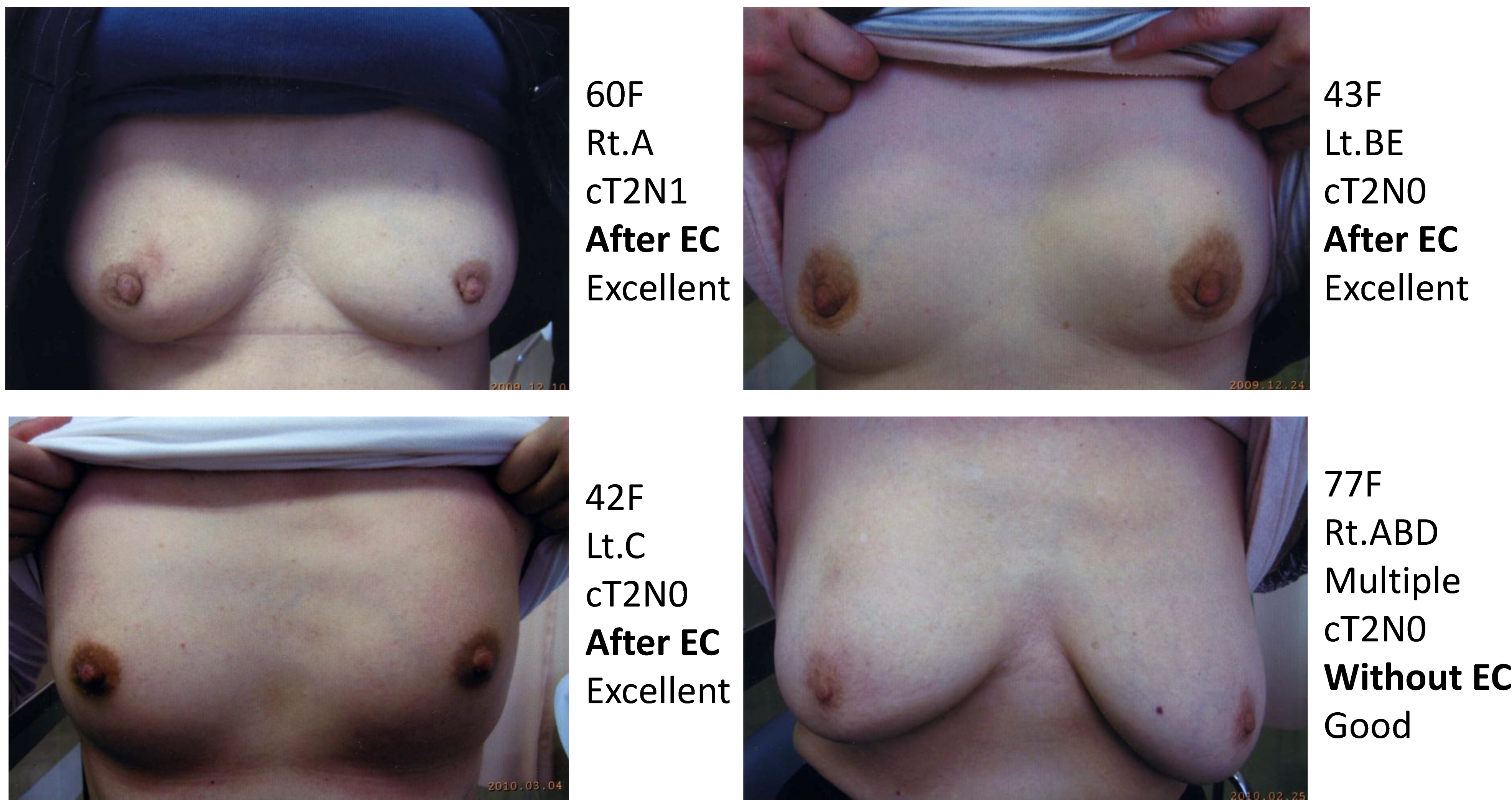 Cancers 07 00891 g008