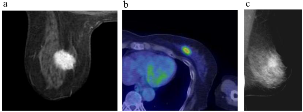 Cancers 08 00001 g002a 1024