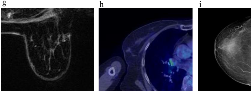 Cancers 08 00001 g003b 1024
