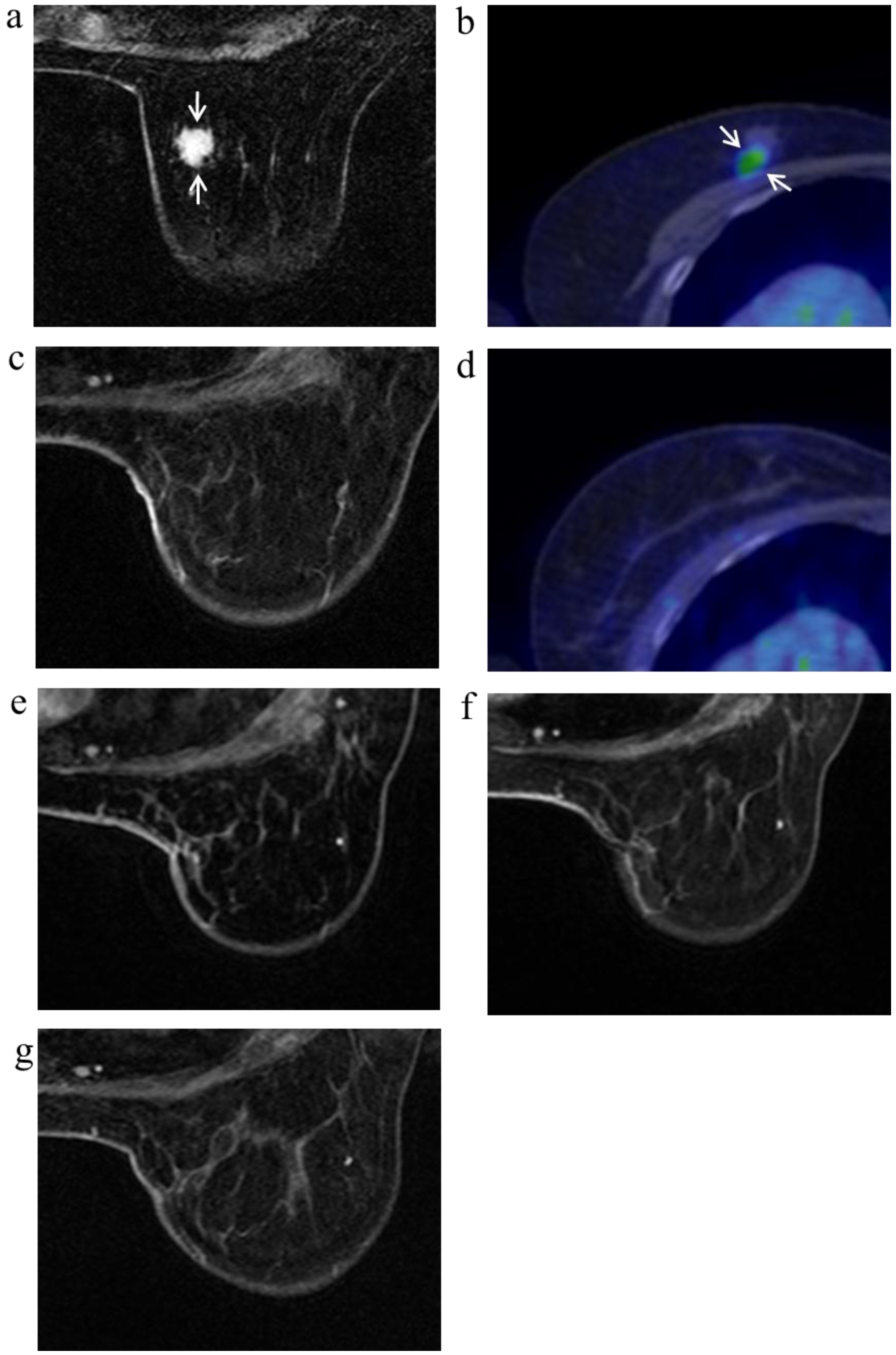 Cancers 08 00001 g004