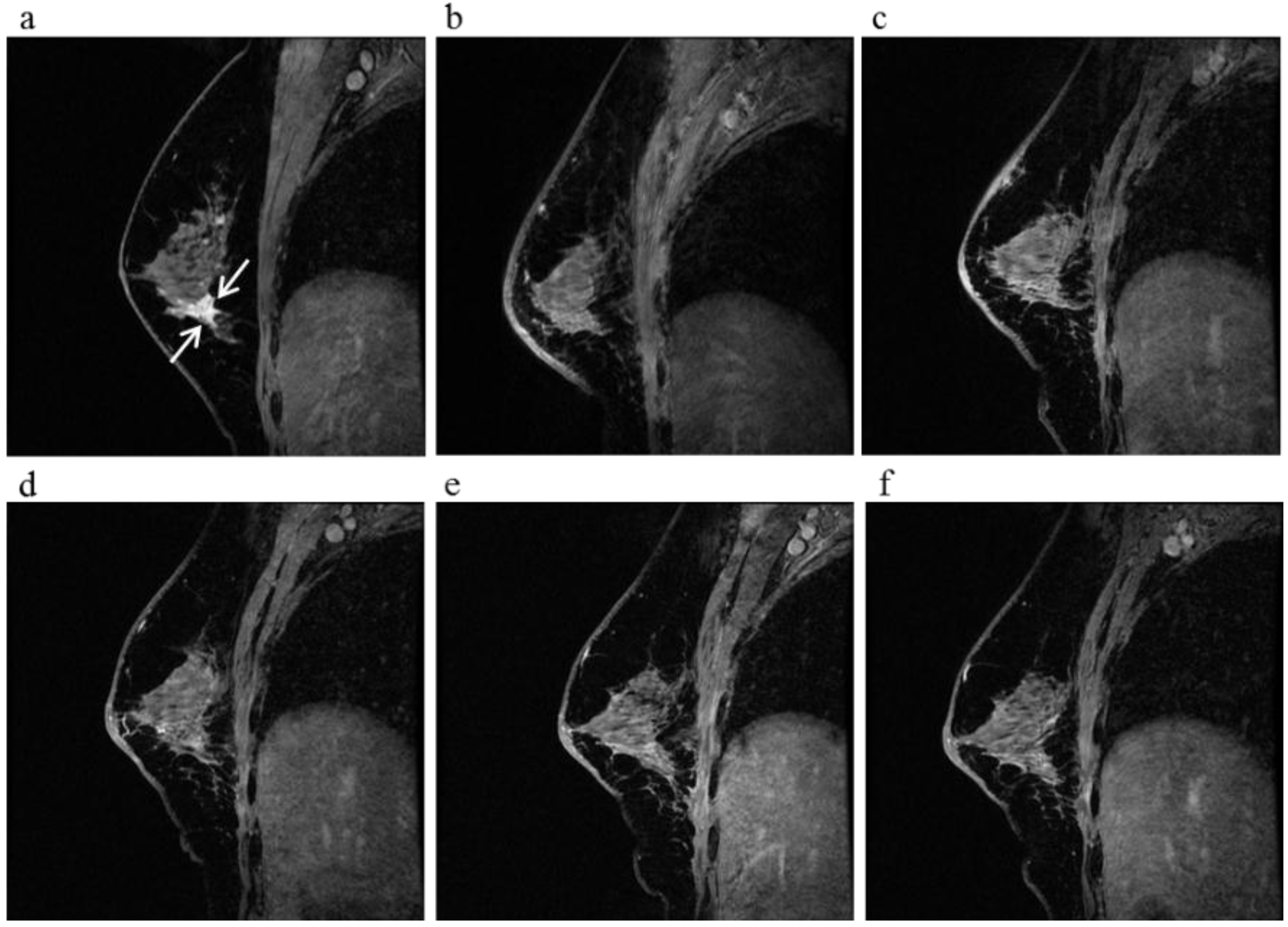 Cancers 08 00001 g005