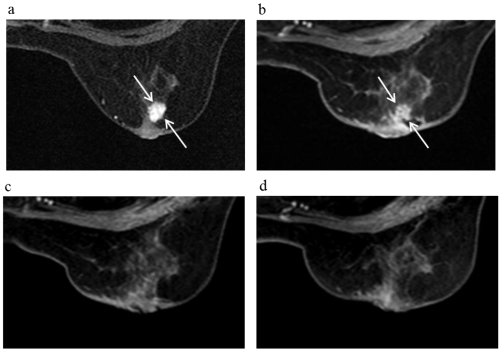 Cancers 08 00001 g007 1024