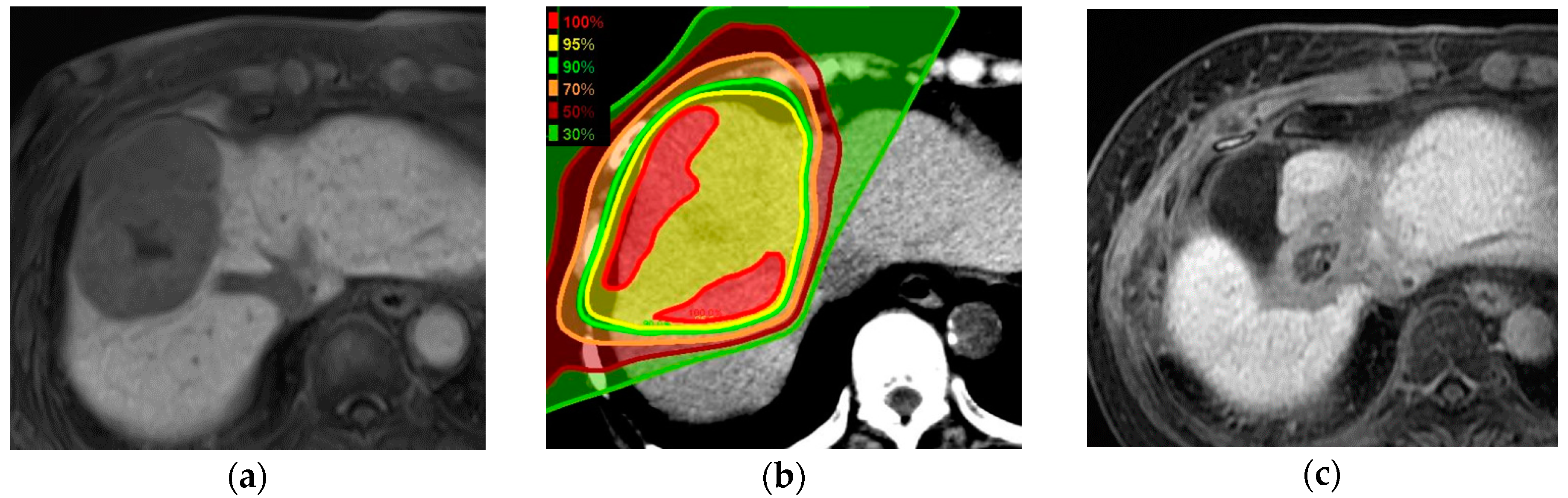 Cancers 10 00071 g002