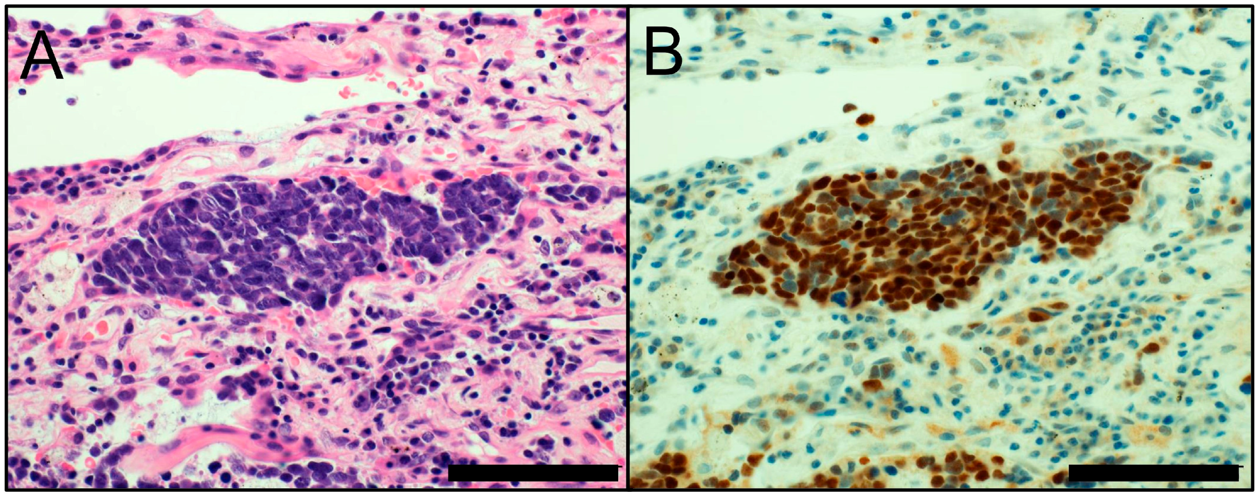 Cancers 10 00072 g002