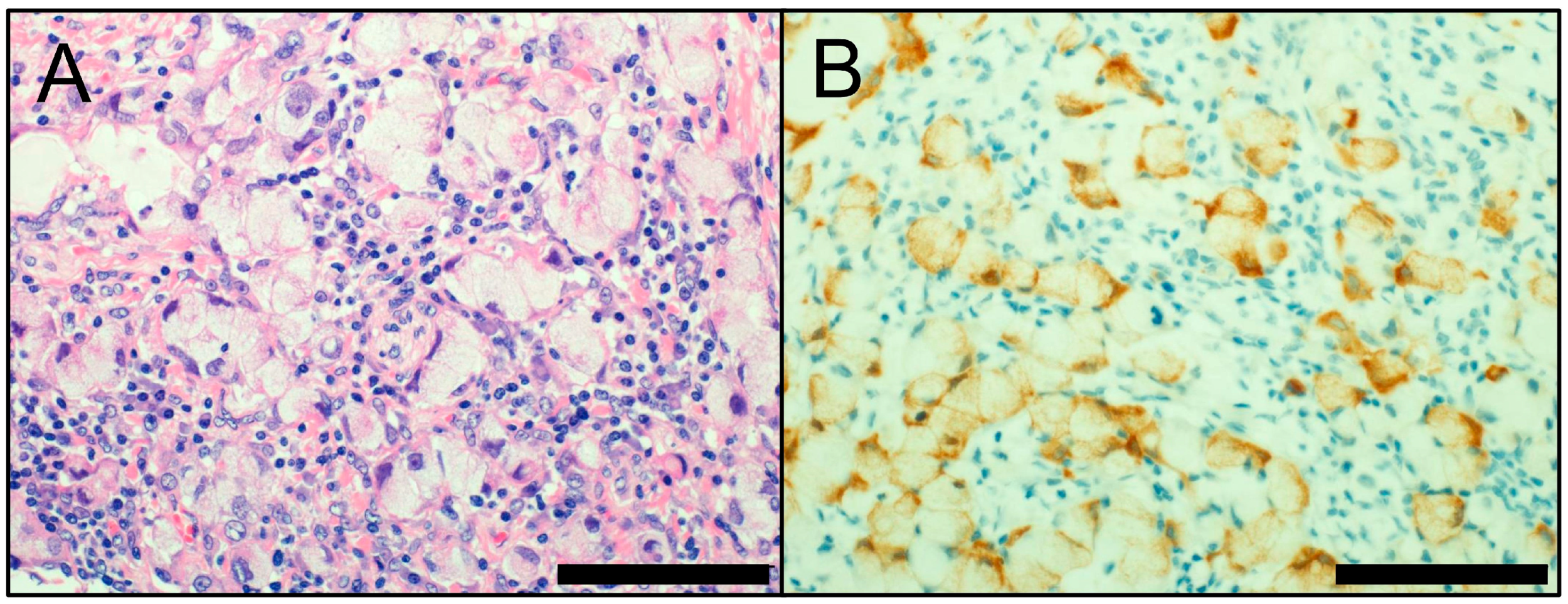 Cancers 10 00072 g003