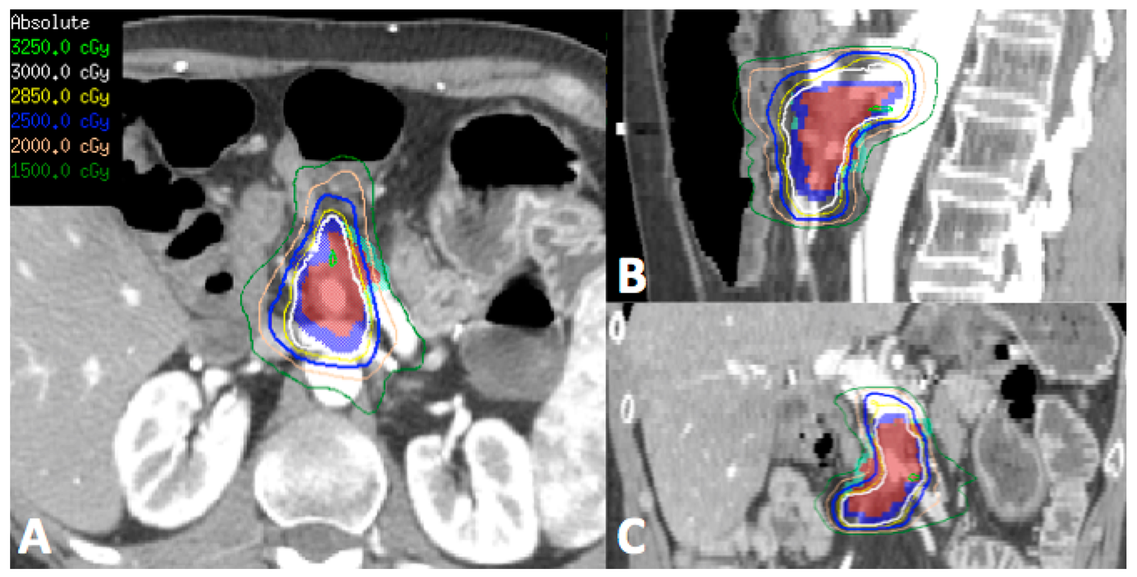 Cancers 10 00075 g001