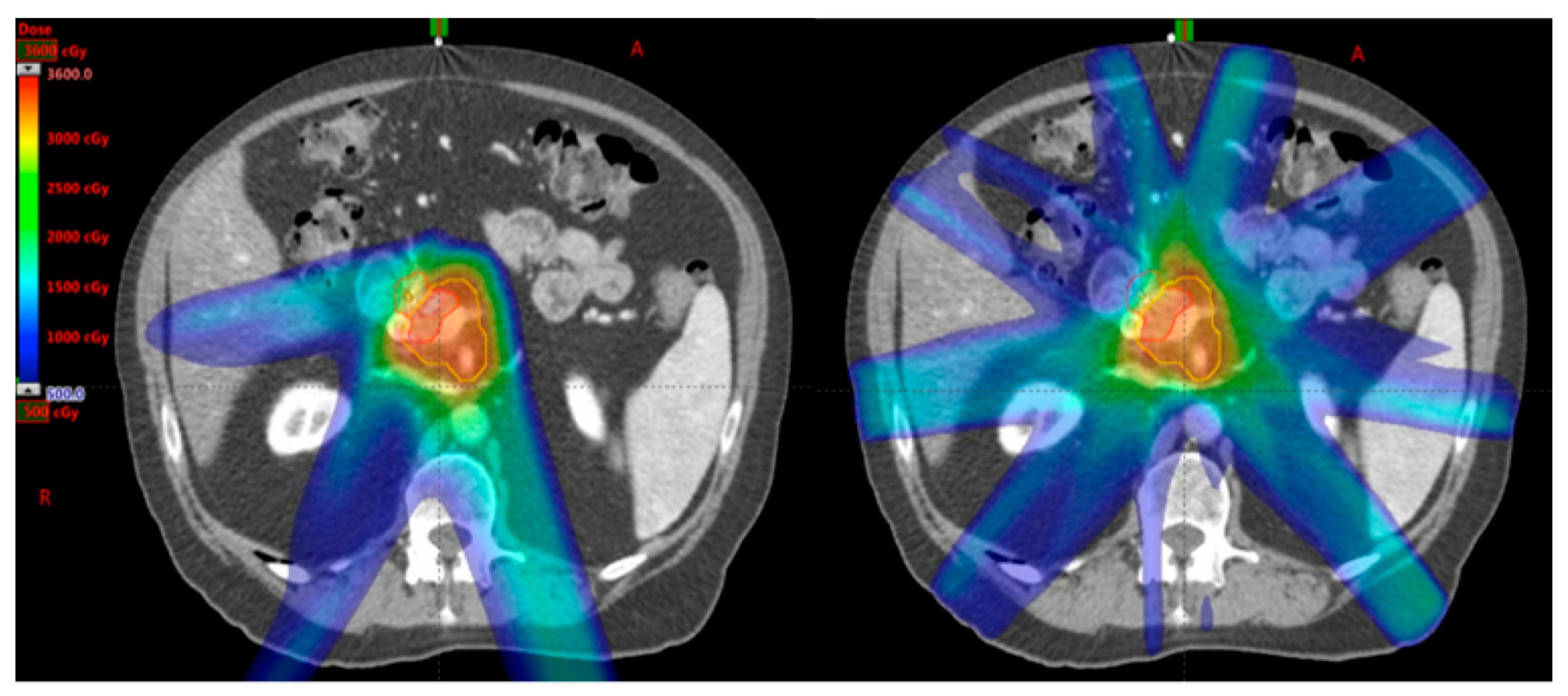 Cancers 10 00075 g002