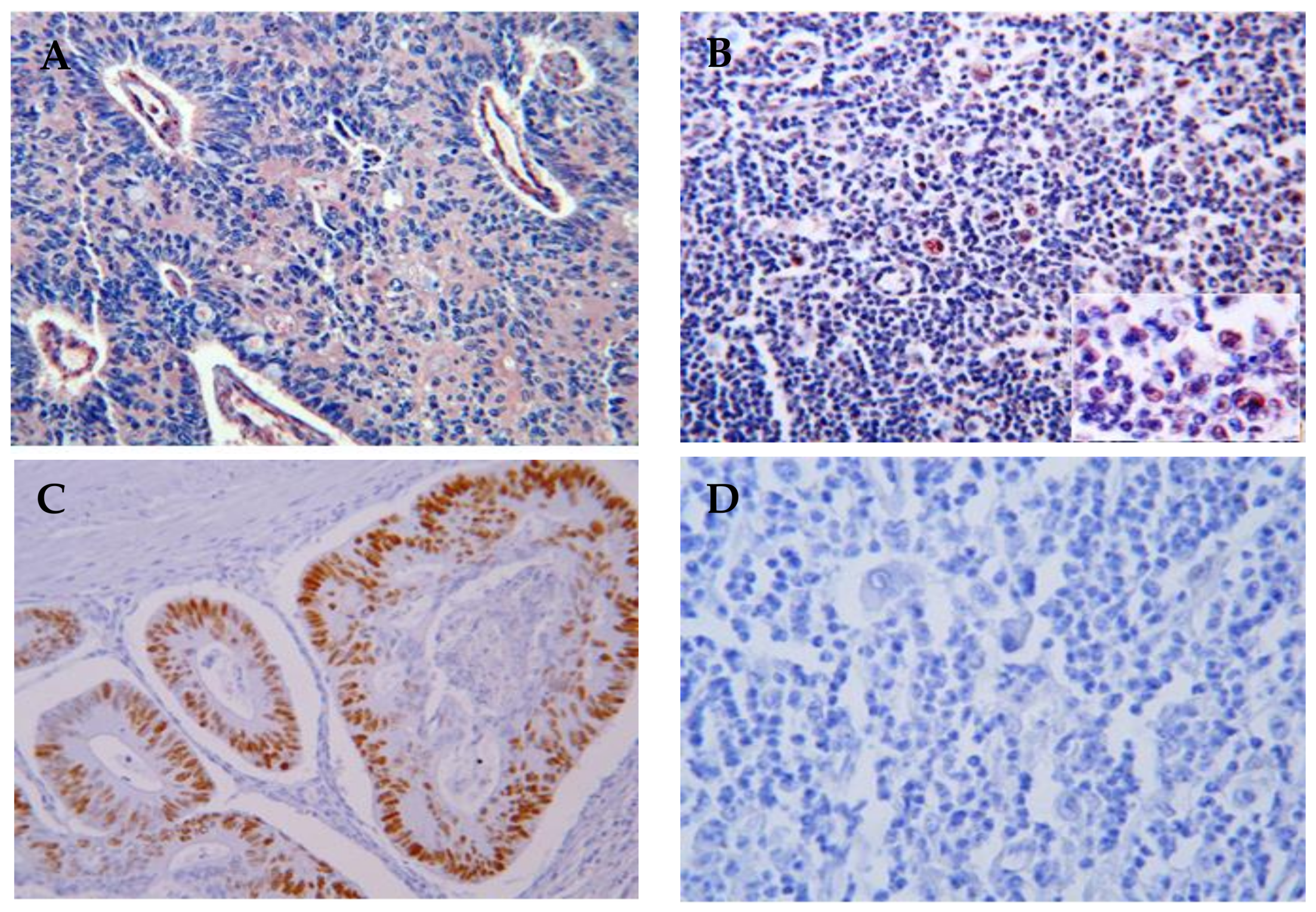 Cancers 10 00091 g001