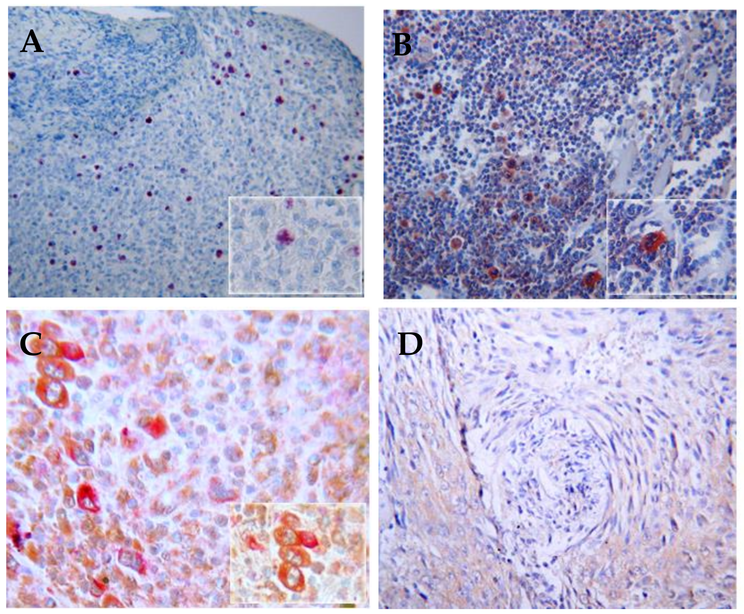 Cancers 10 00091 g003