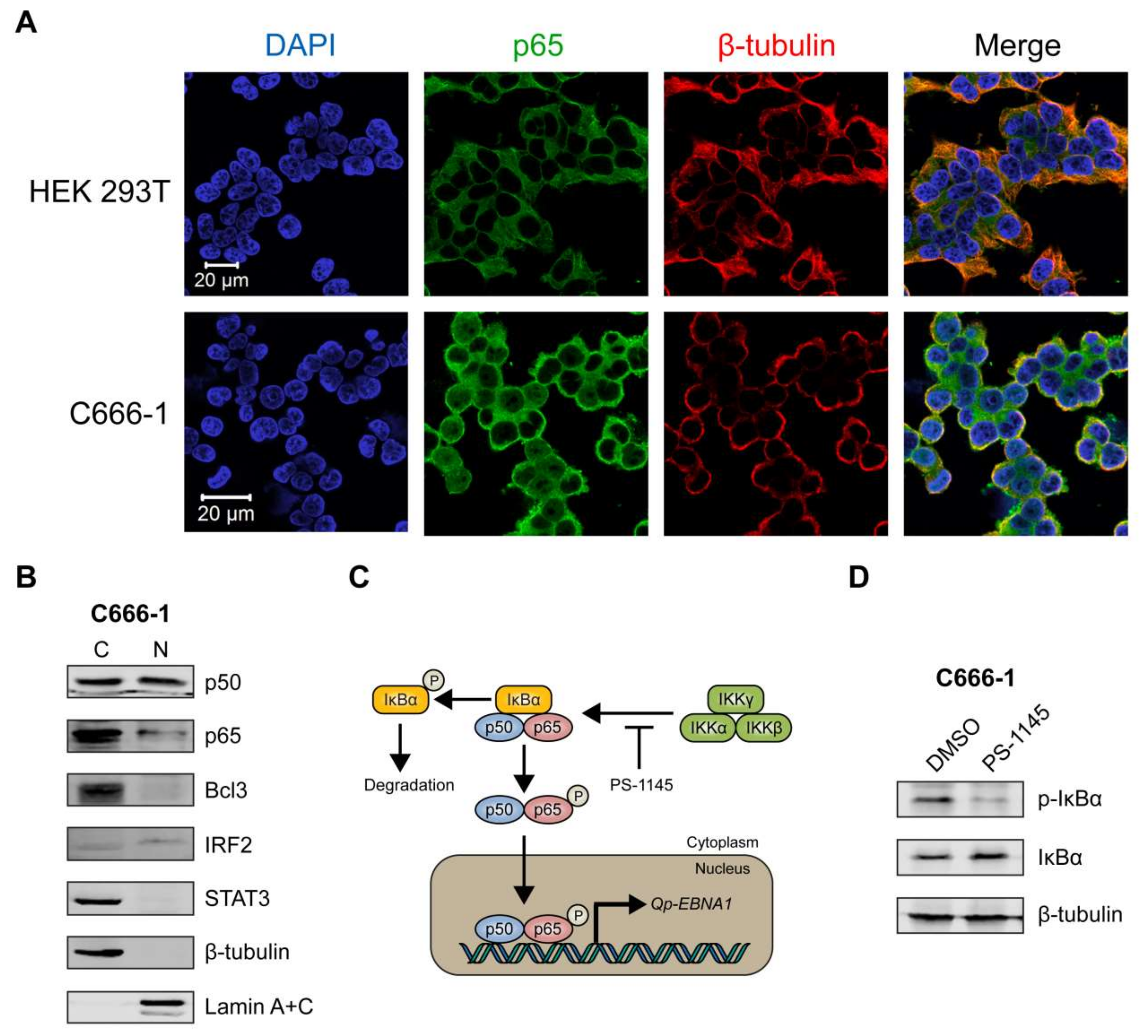 Cancers 10 00119 g004a Cancers 10 00119 g004a