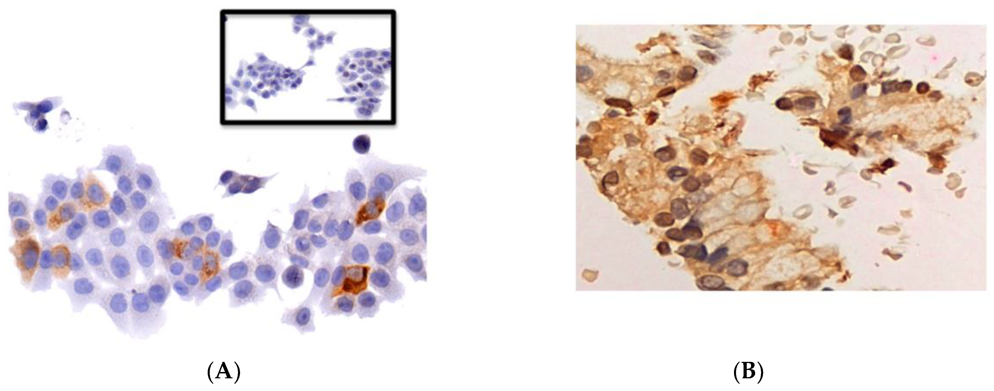 Cancers 10 00160 g002a