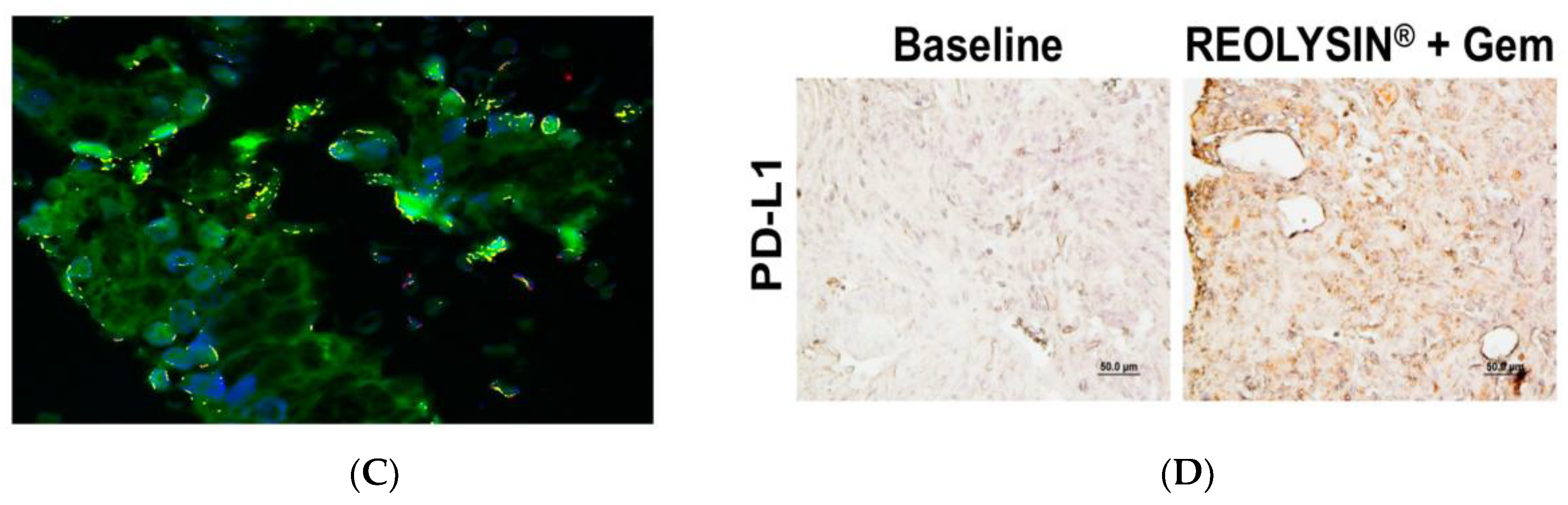 Cancers 10 00160 g002b