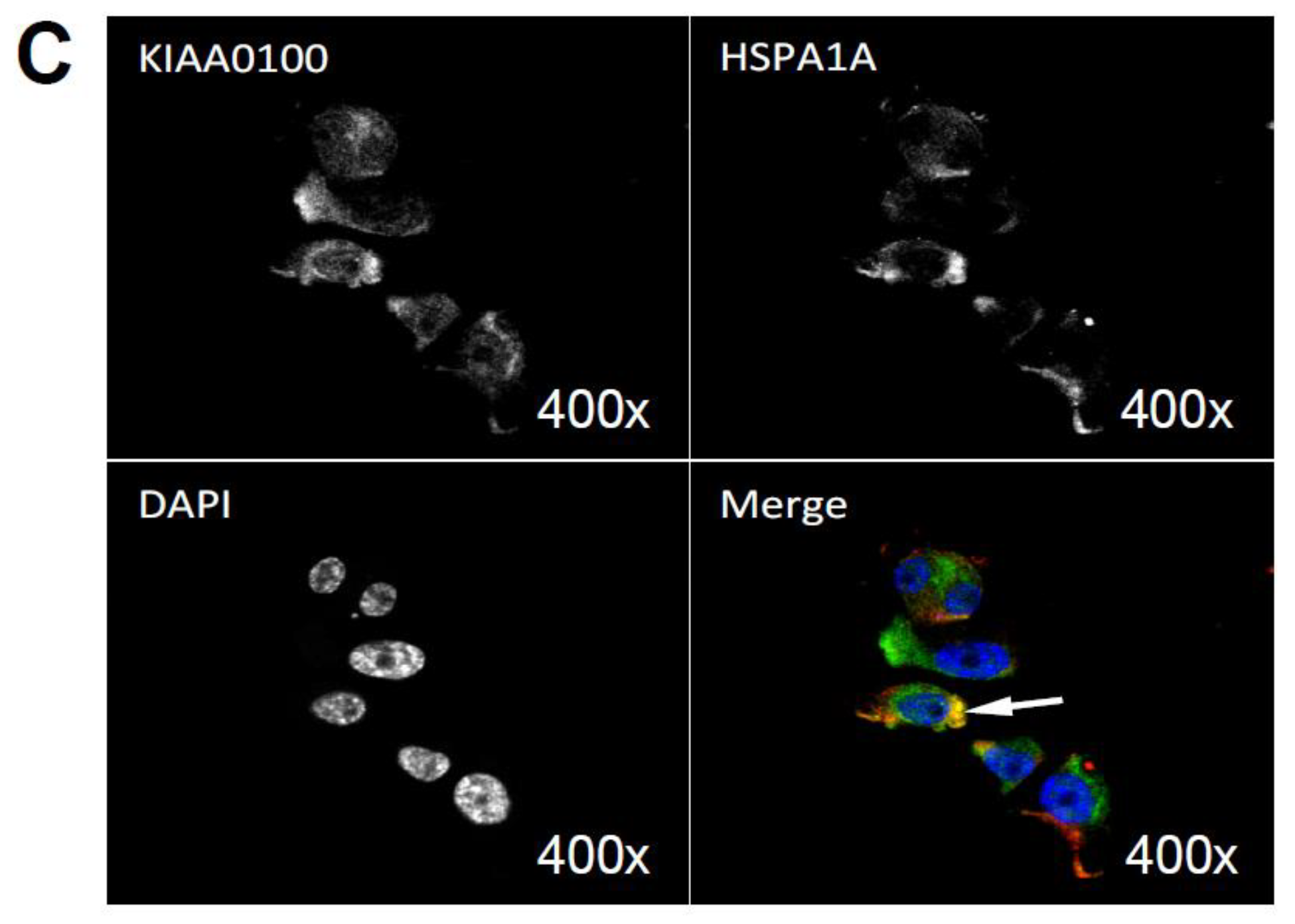 Cancers 10 00180 g008b Cancers 10 00180 g008b