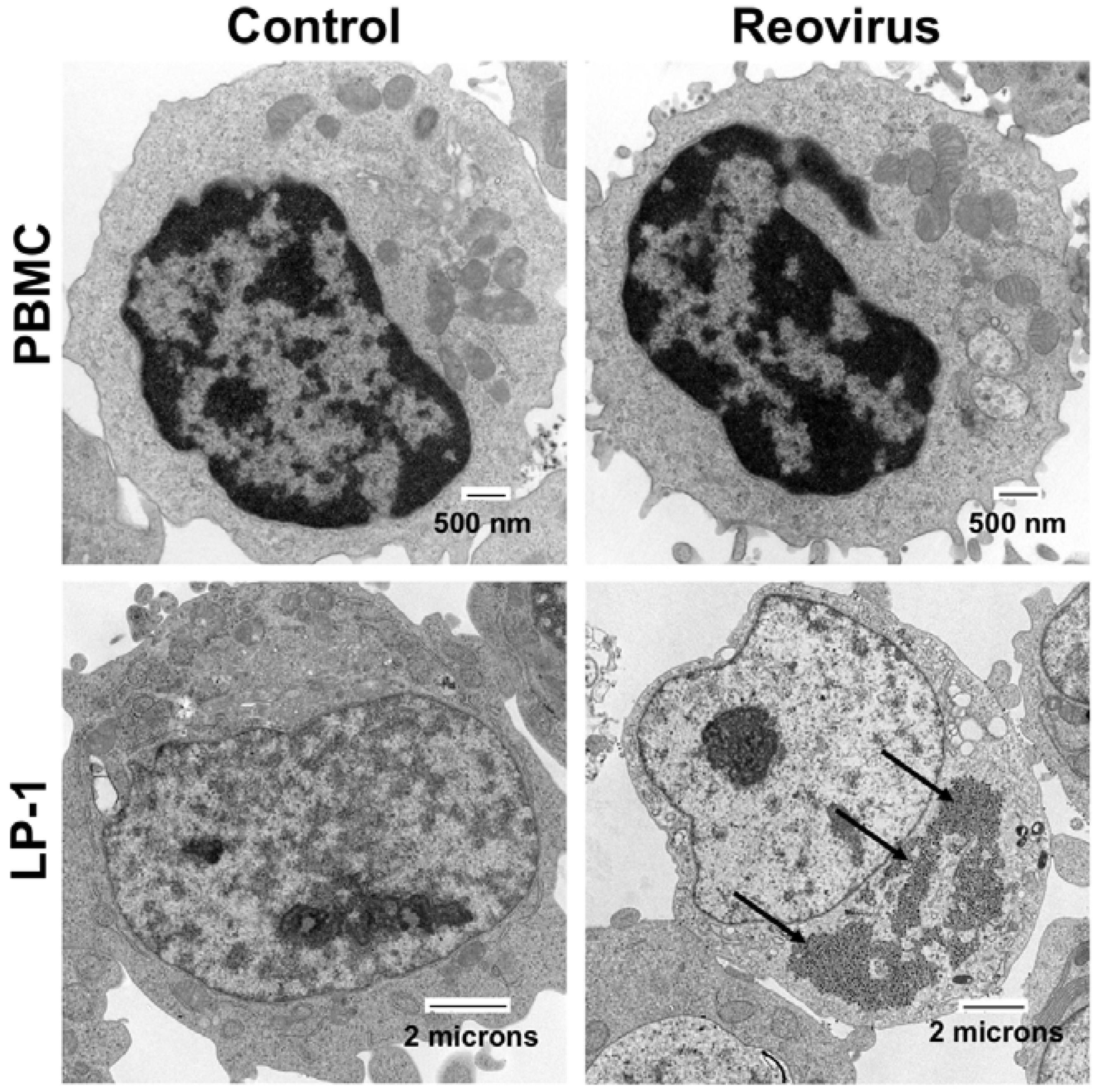 Cancers 10 00198 g001