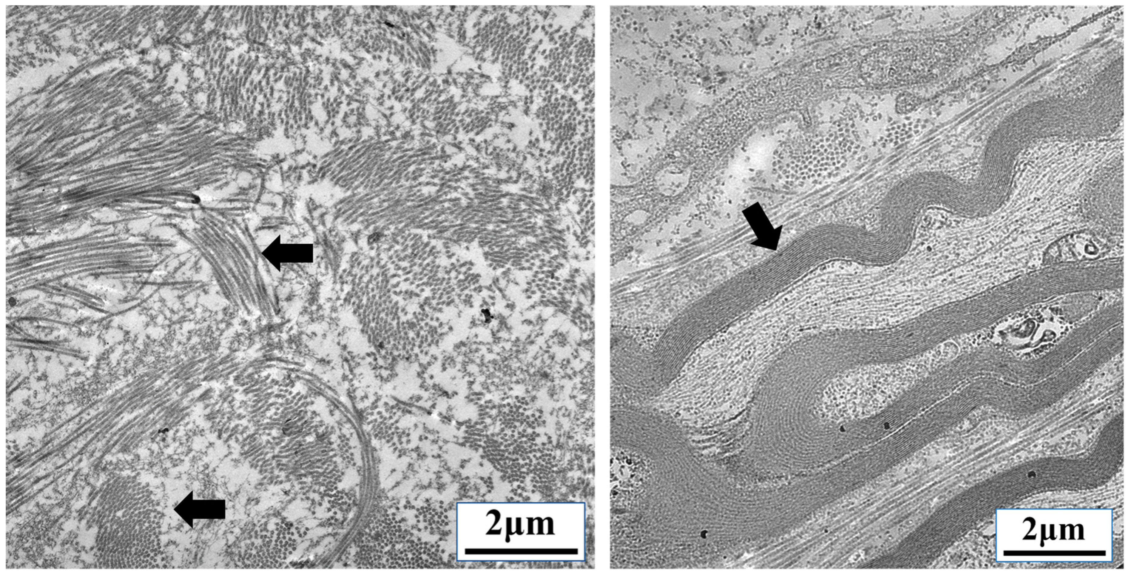 Cancers 10 00199 g004