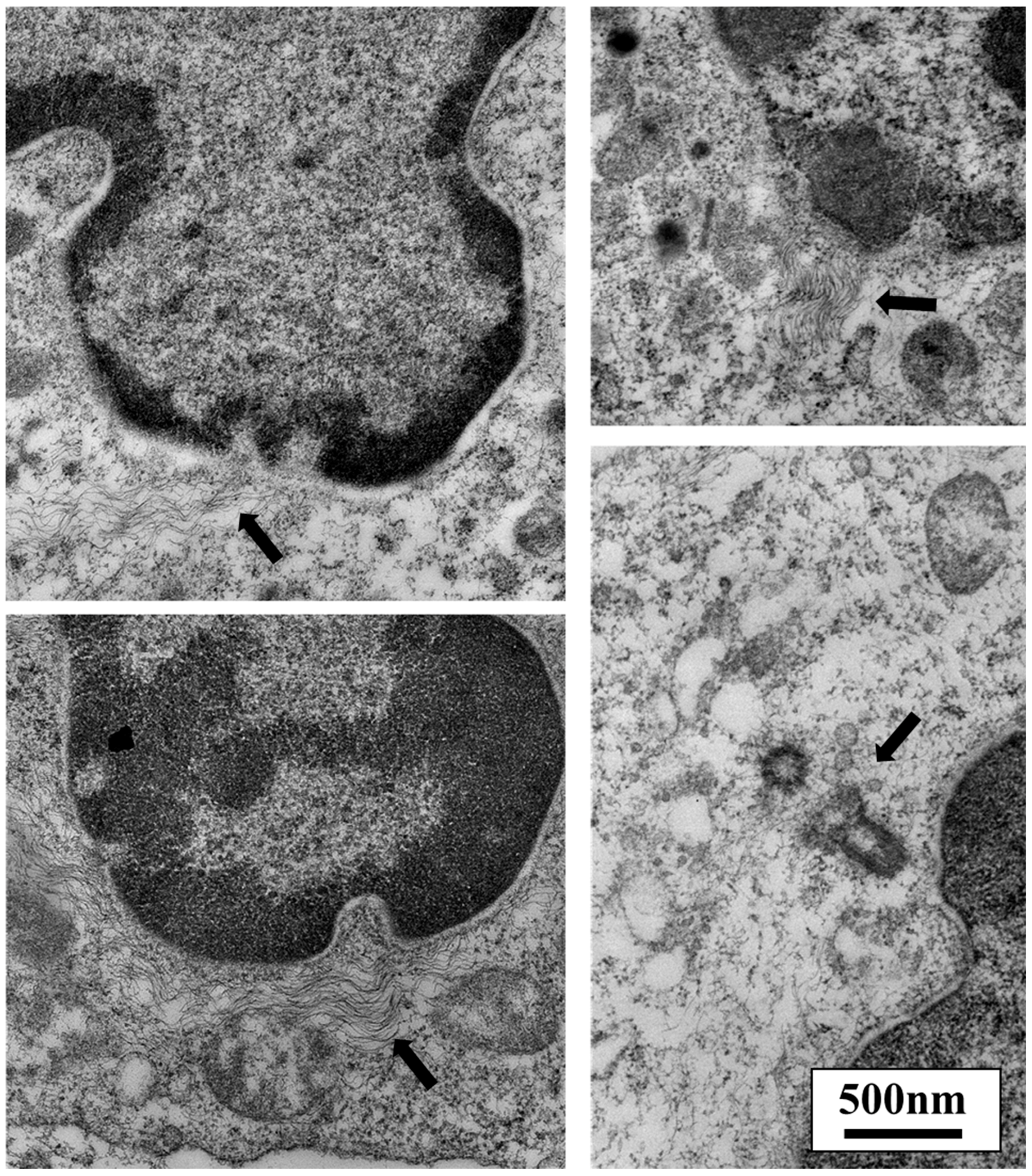 Cancers 10 00199 g006