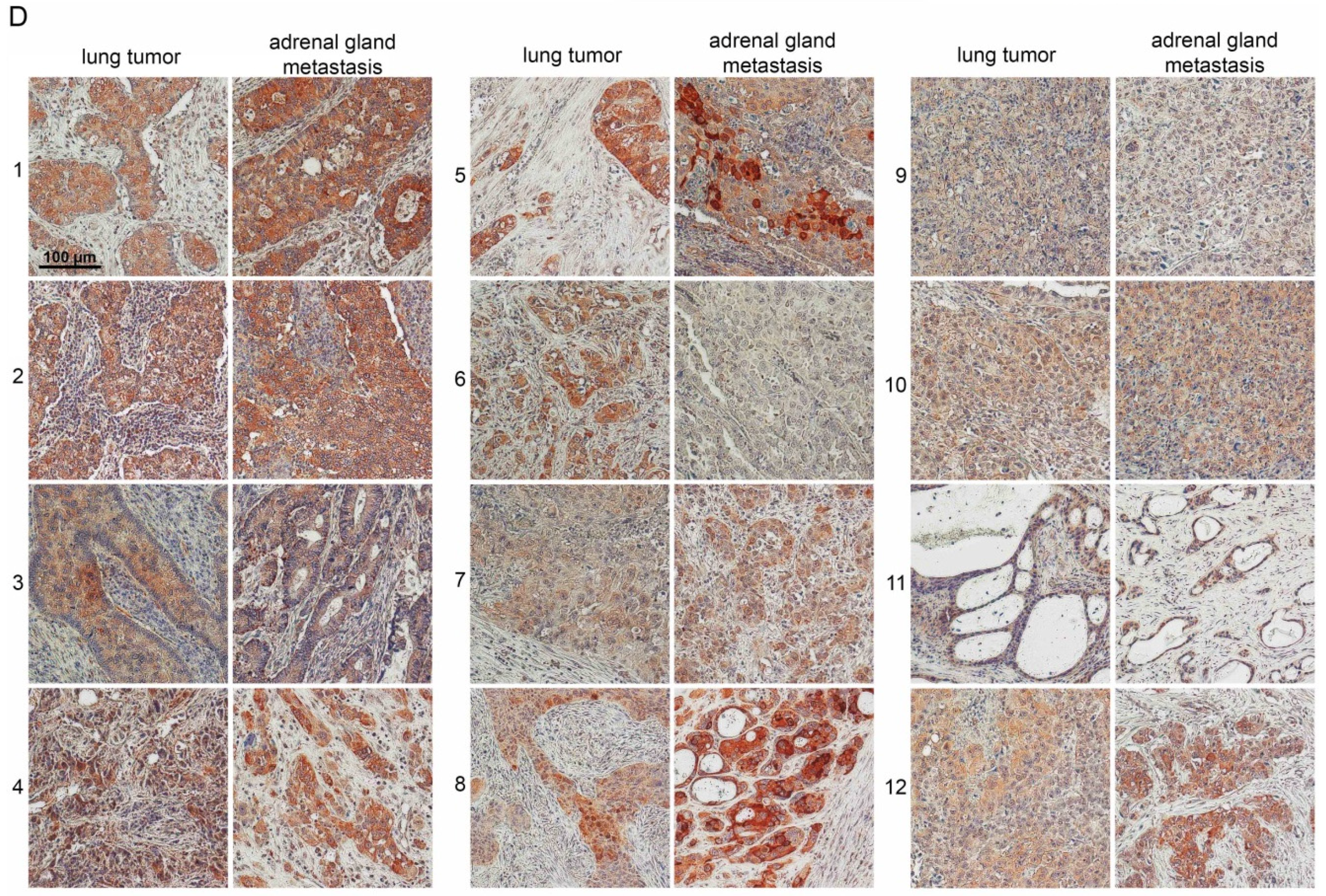 Cancers 10 00486 g001b