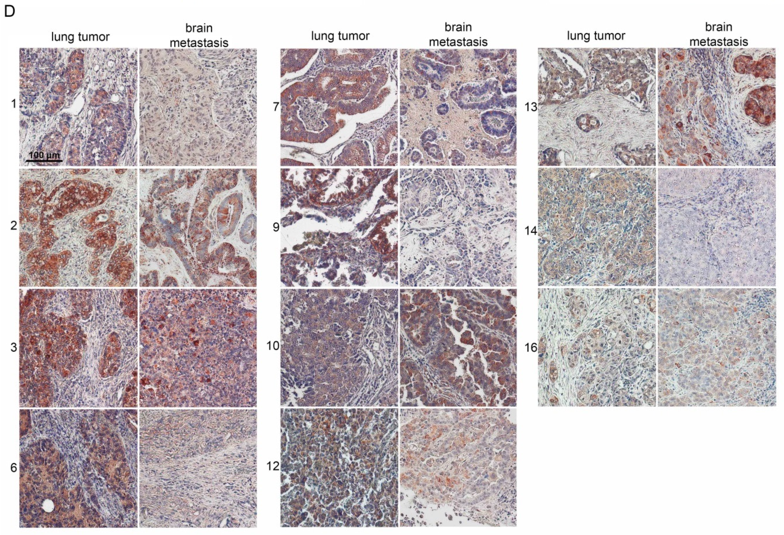 Cancers 10 00486 g002b