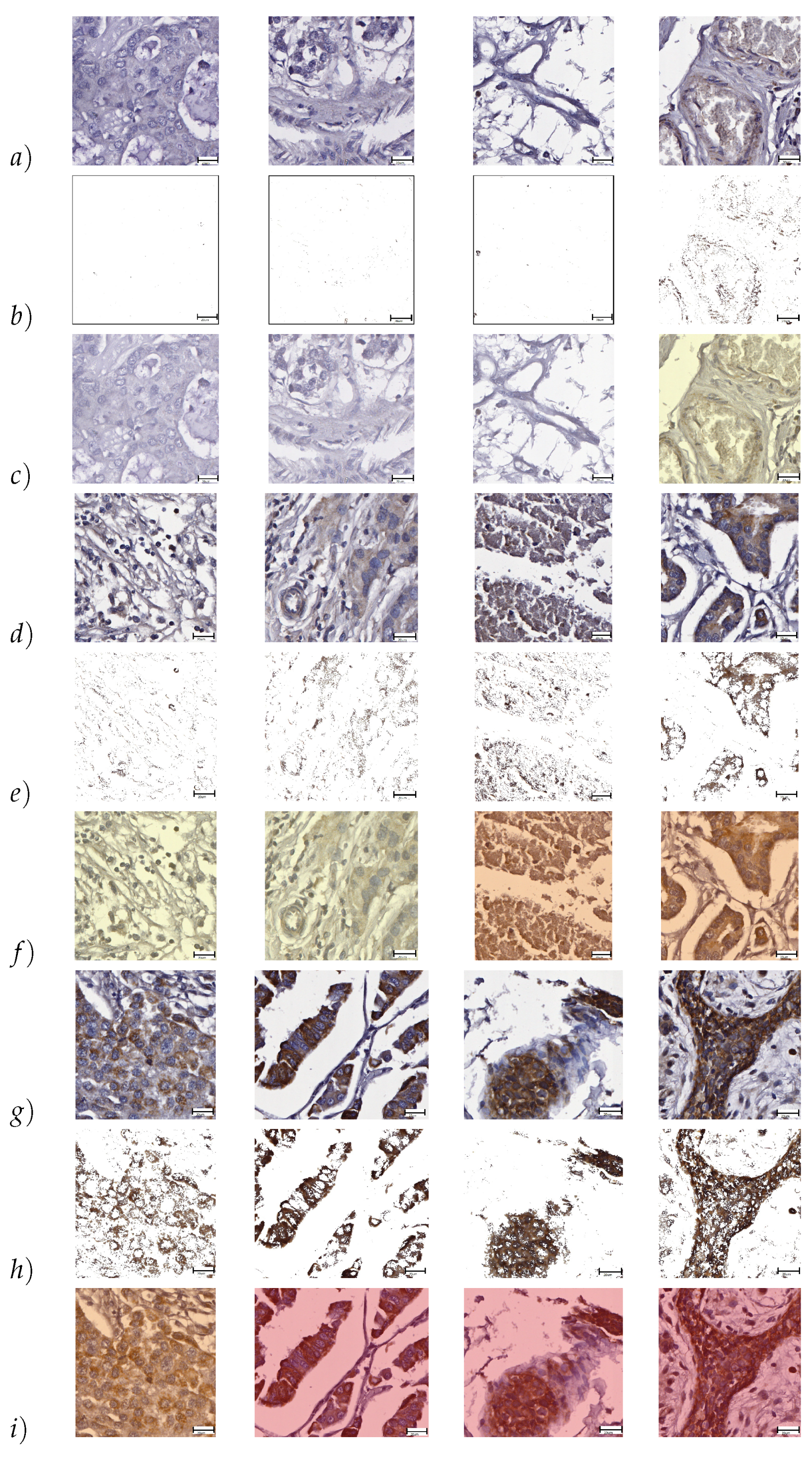 Cancers 10 00517 g002