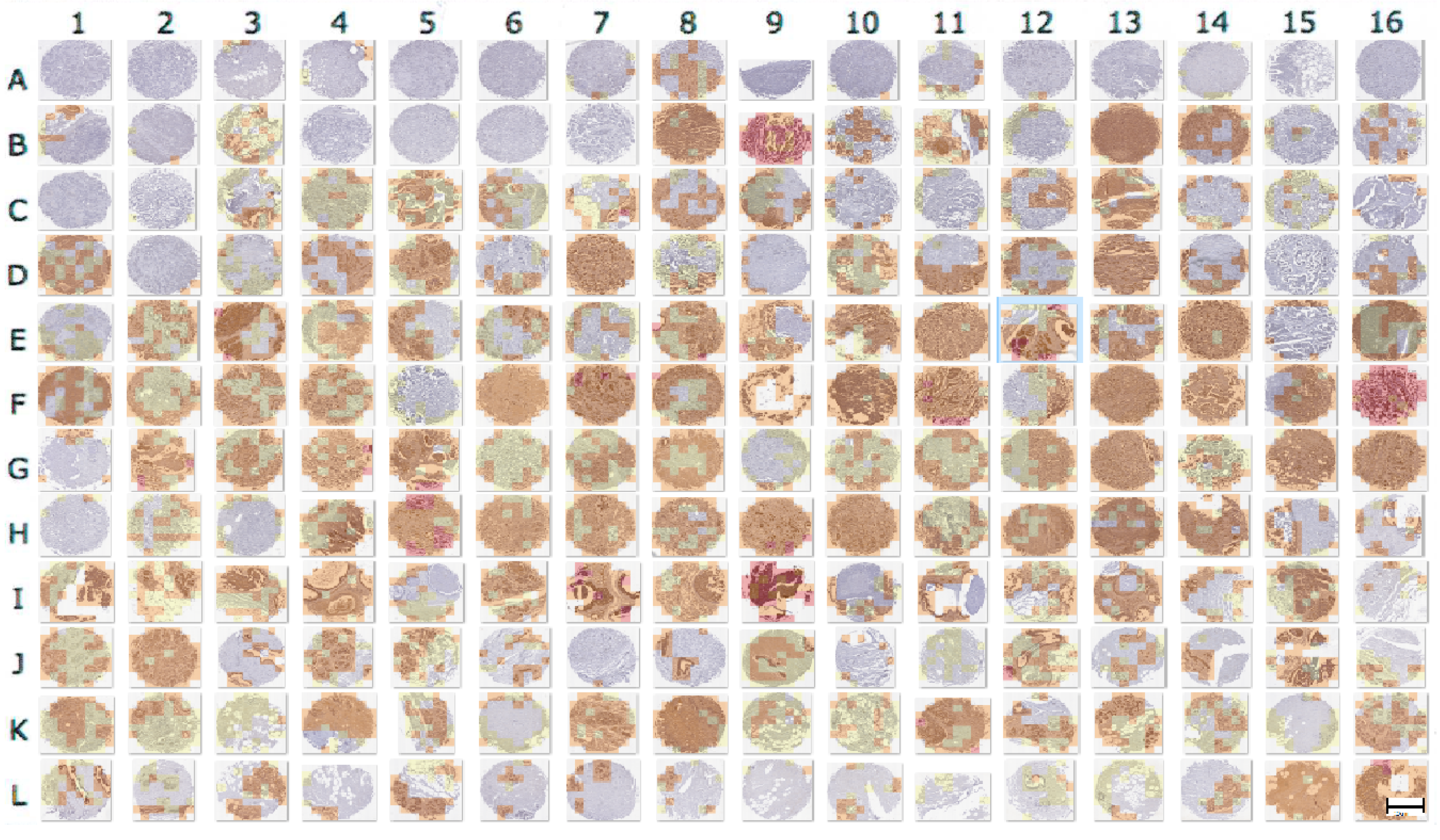 Cancers 10 00517 g005