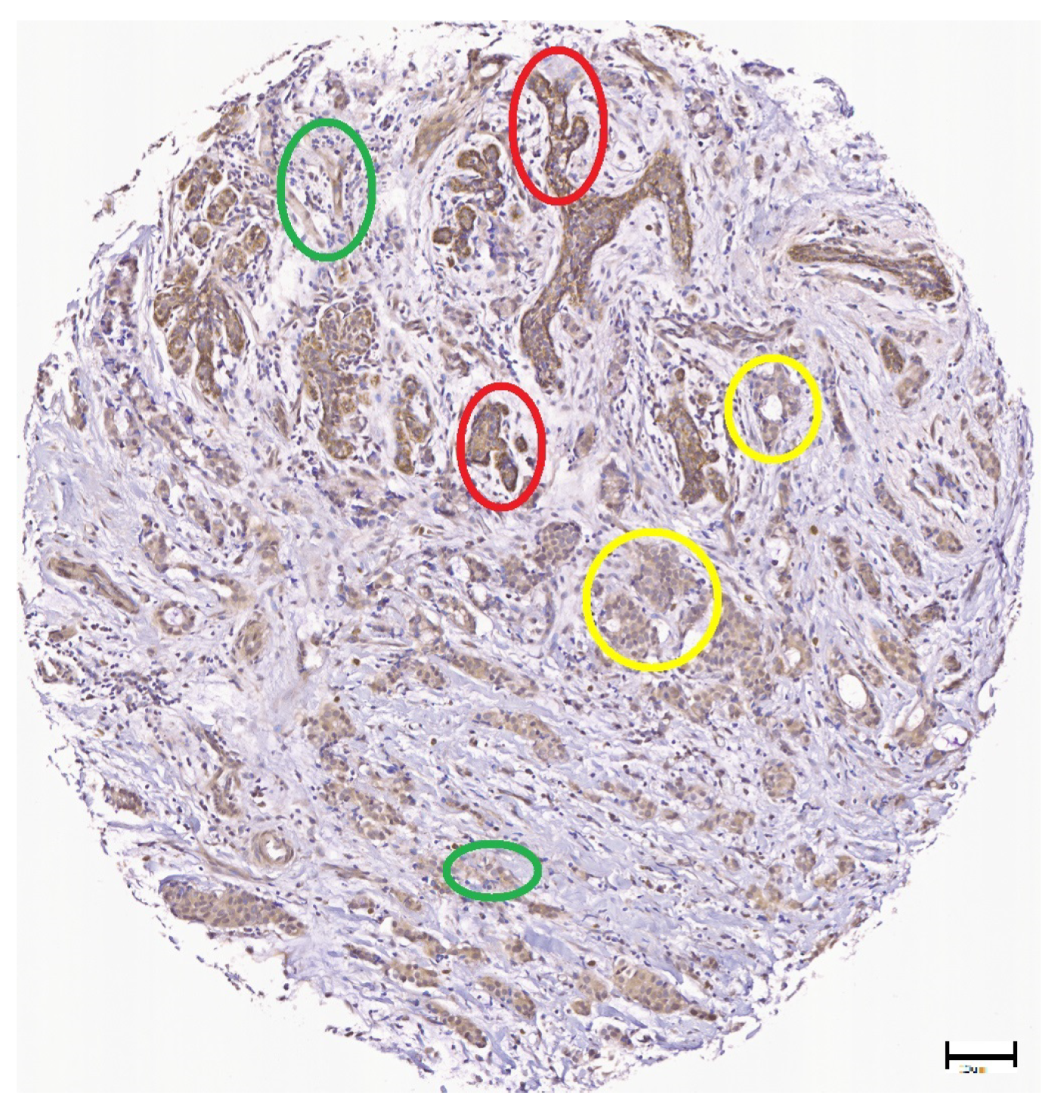 Cancers 10 00517 g008