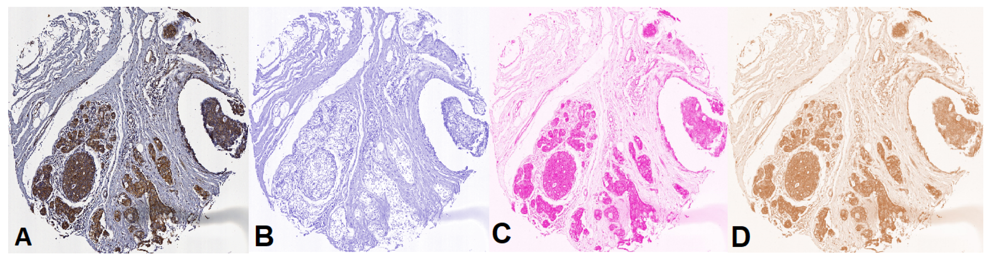 Cancers 10 00517 g010