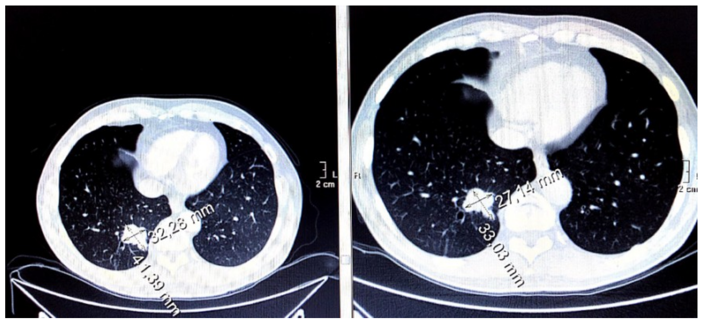 Cancers 11 00030 g005