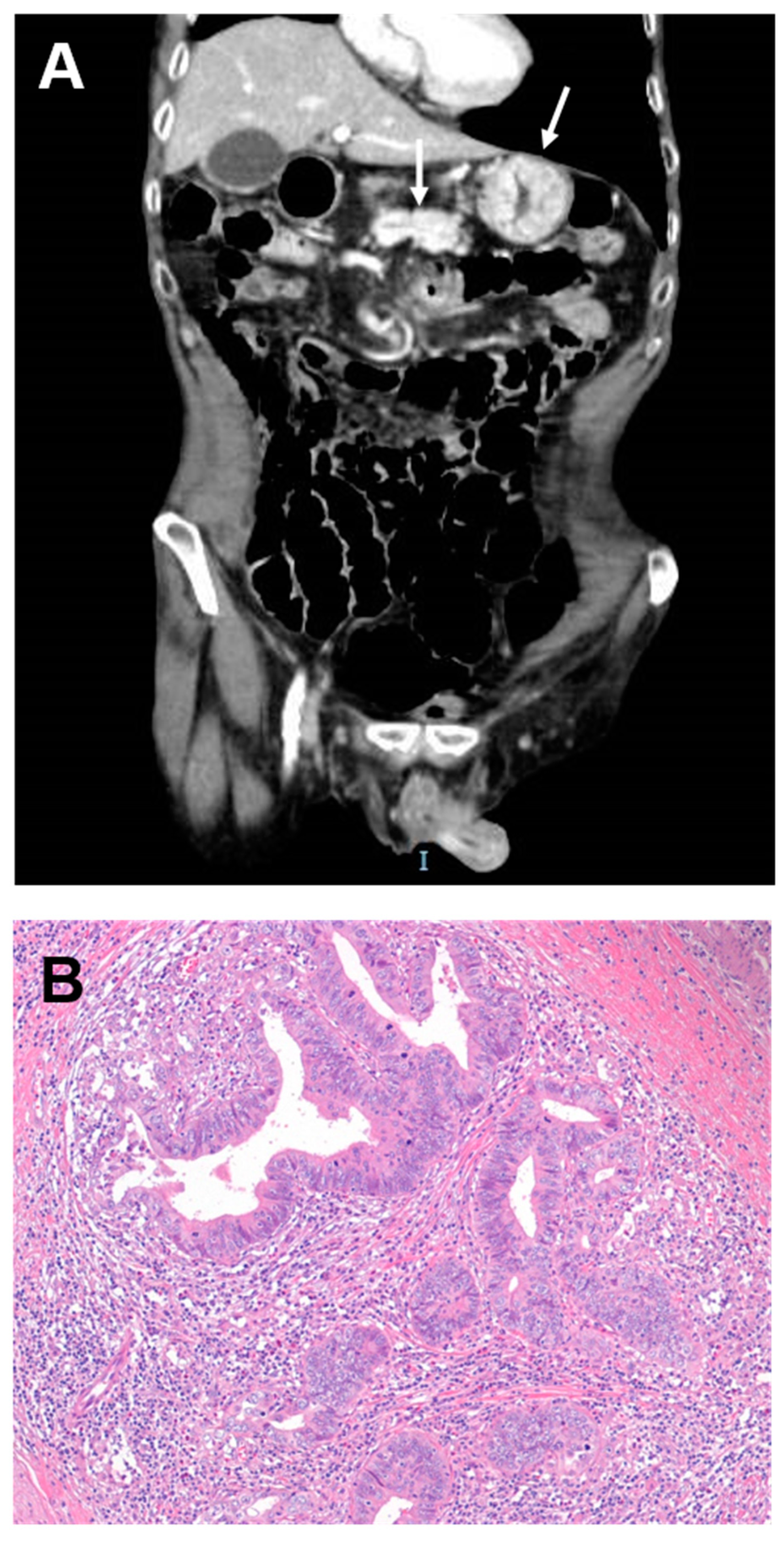 Cancers 11 00031 g002 Cancers 11 00031 g002