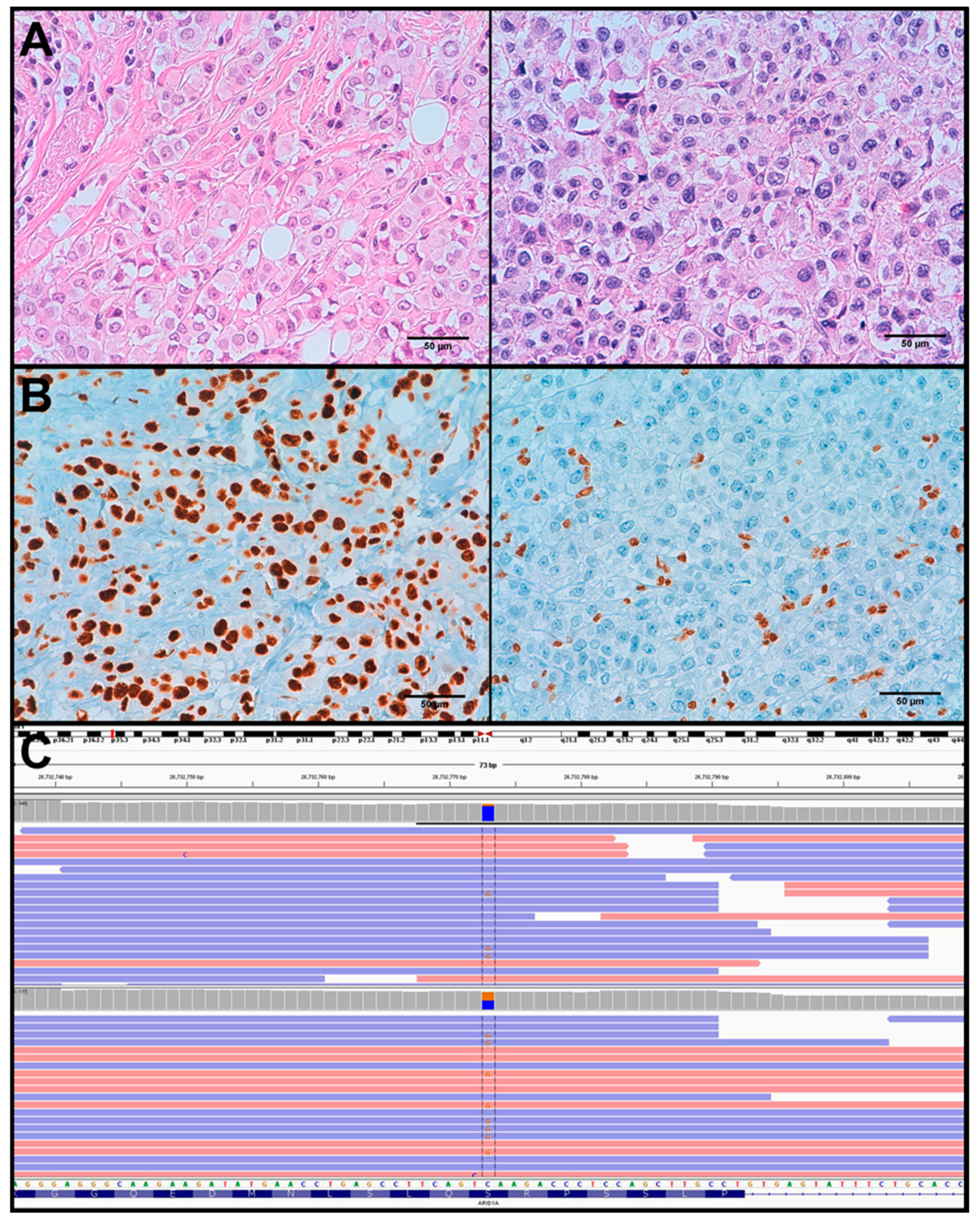 Cancers 11 00074 g004