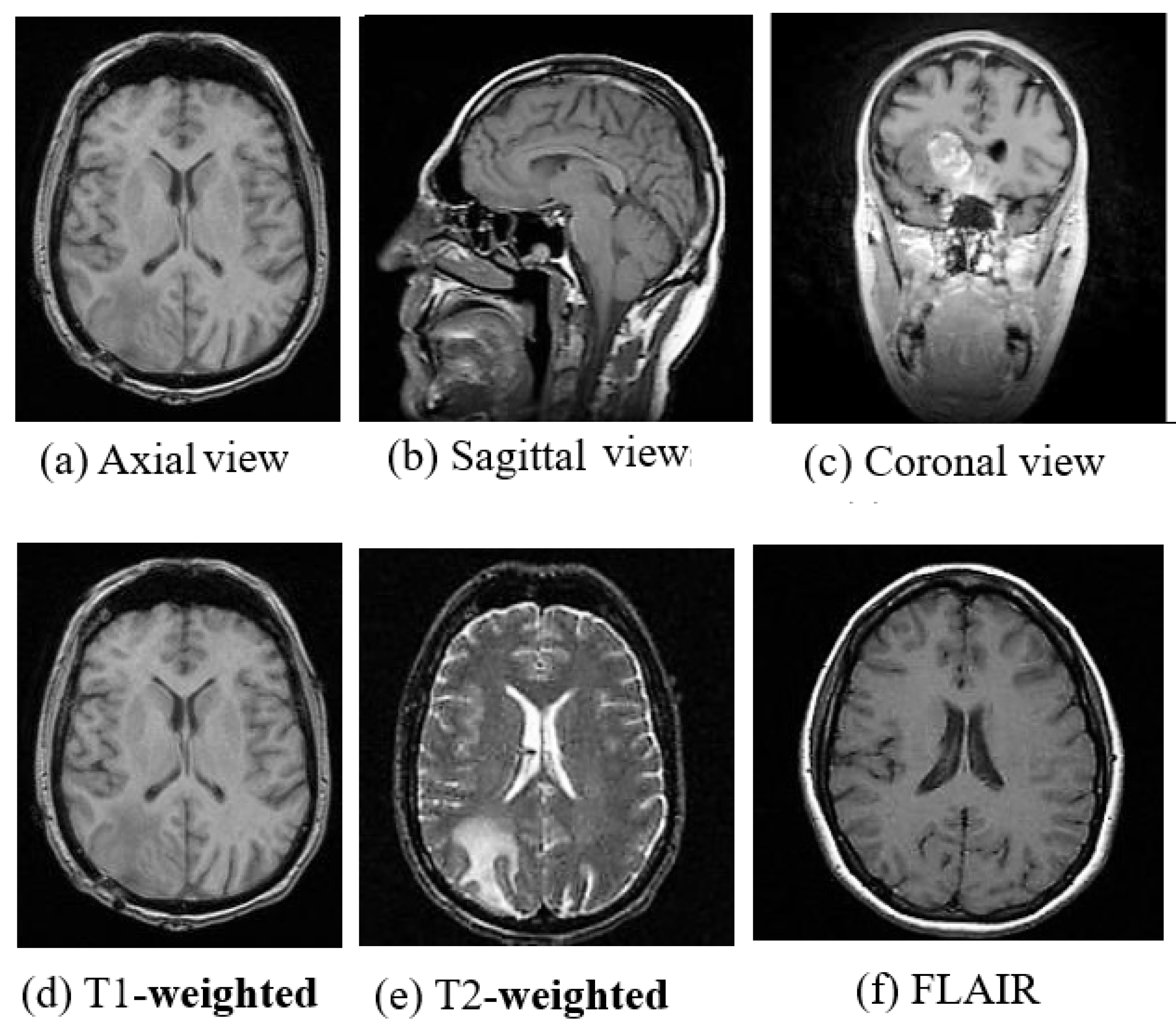 Cancers 11 00111 g002