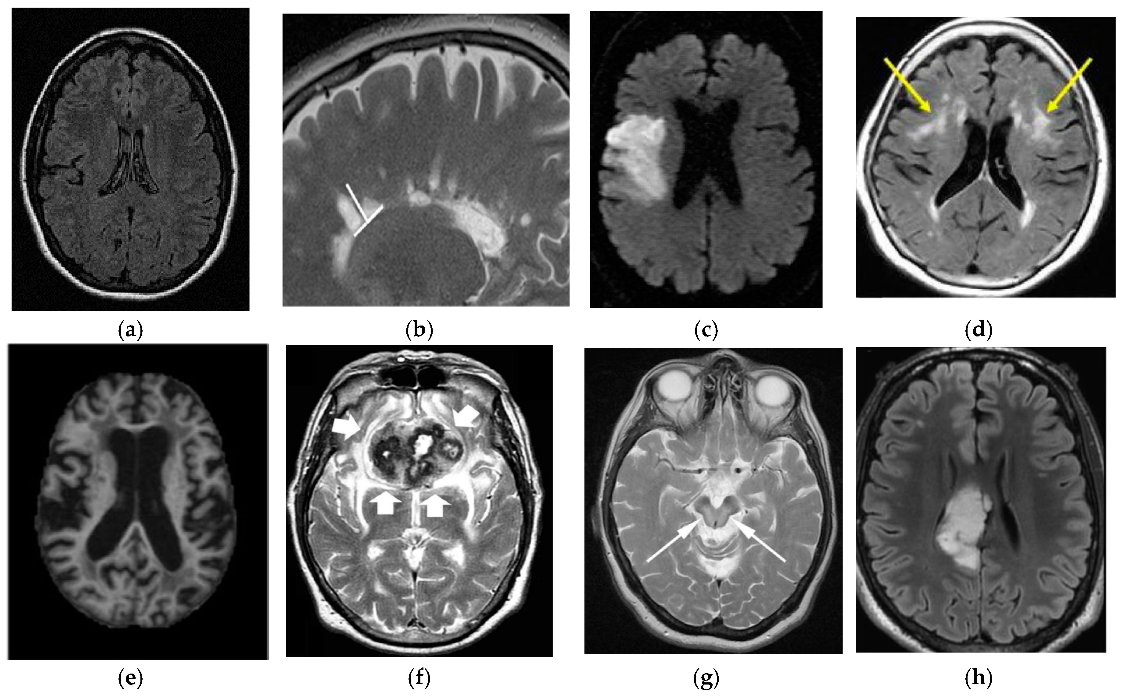 Cancers 11 00111 g017