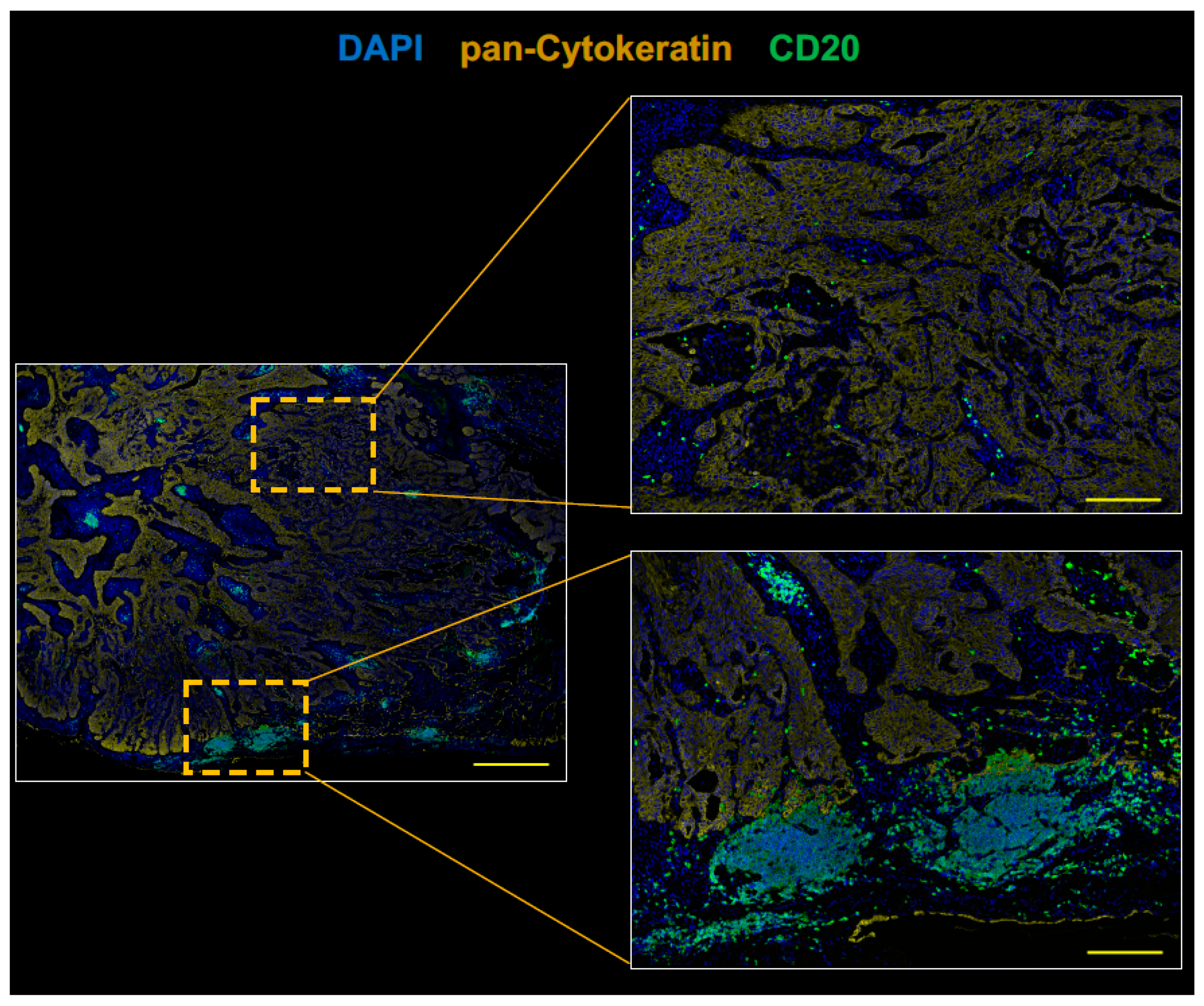 Cancers 11 00140 g003 Cancers 11 00140 g003