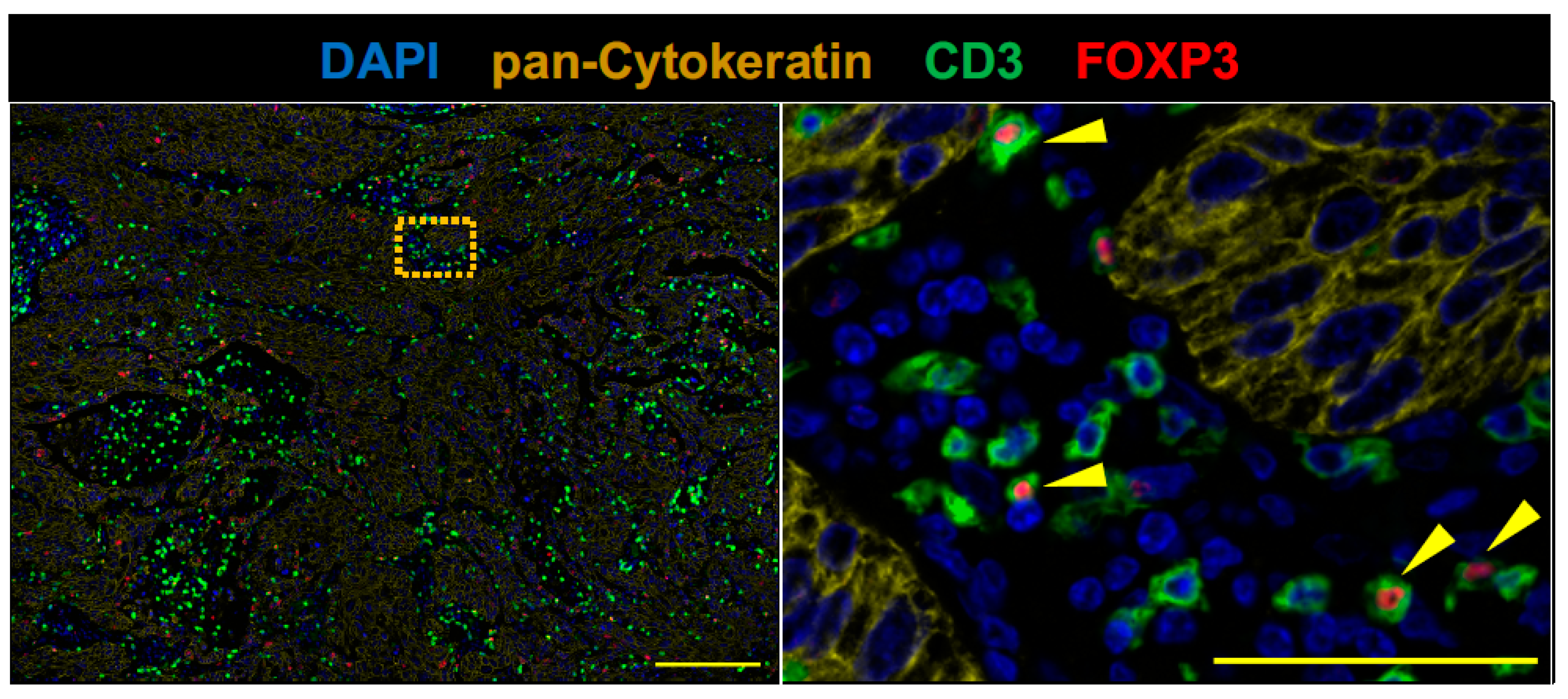 Cancers 11 00140 g004 Cancers 11 00140 g004
