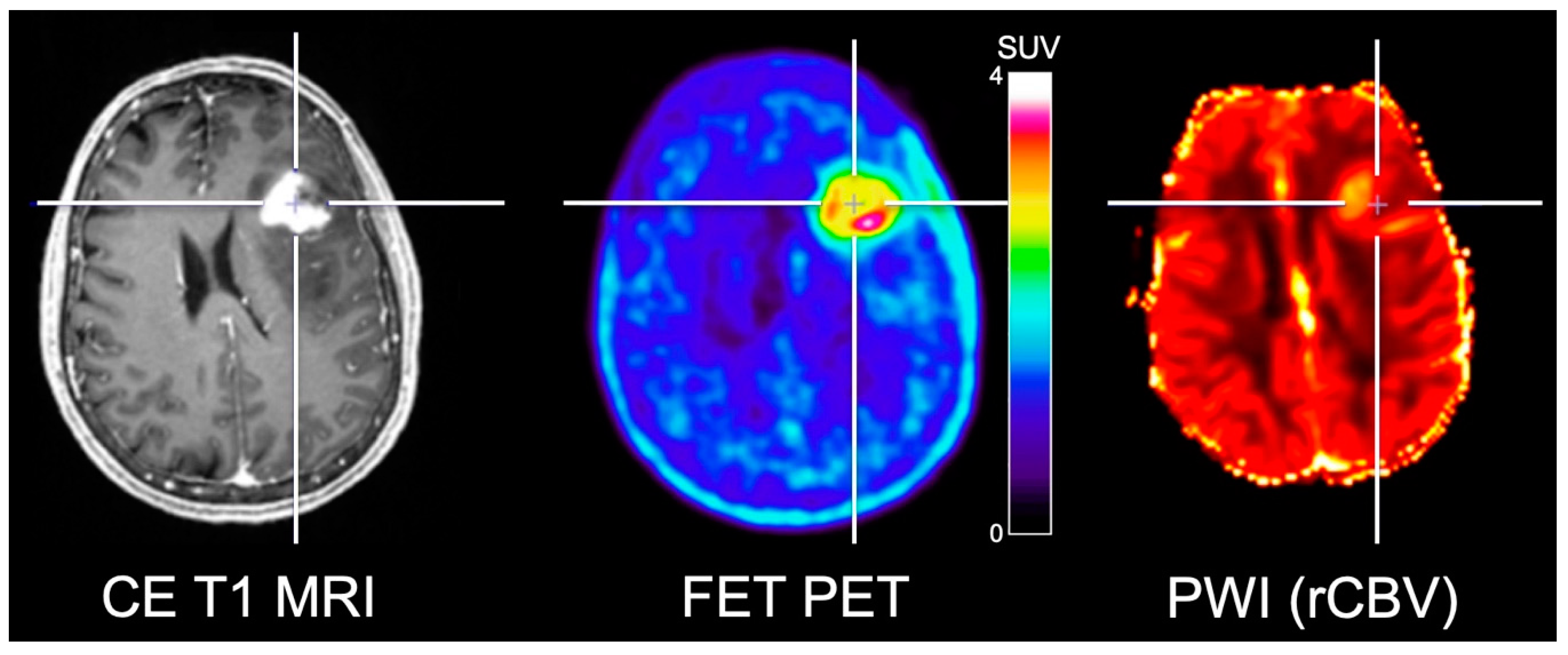 Cancers 11 00153 g002