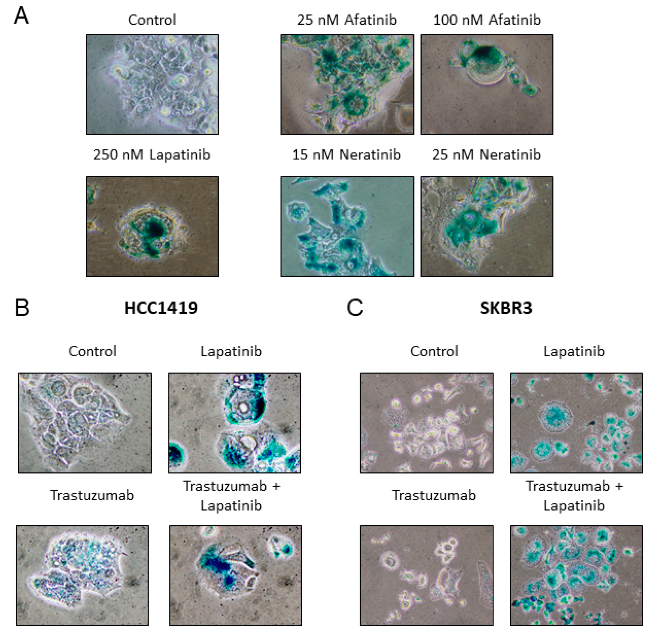 Cancers 11 00197 g004
