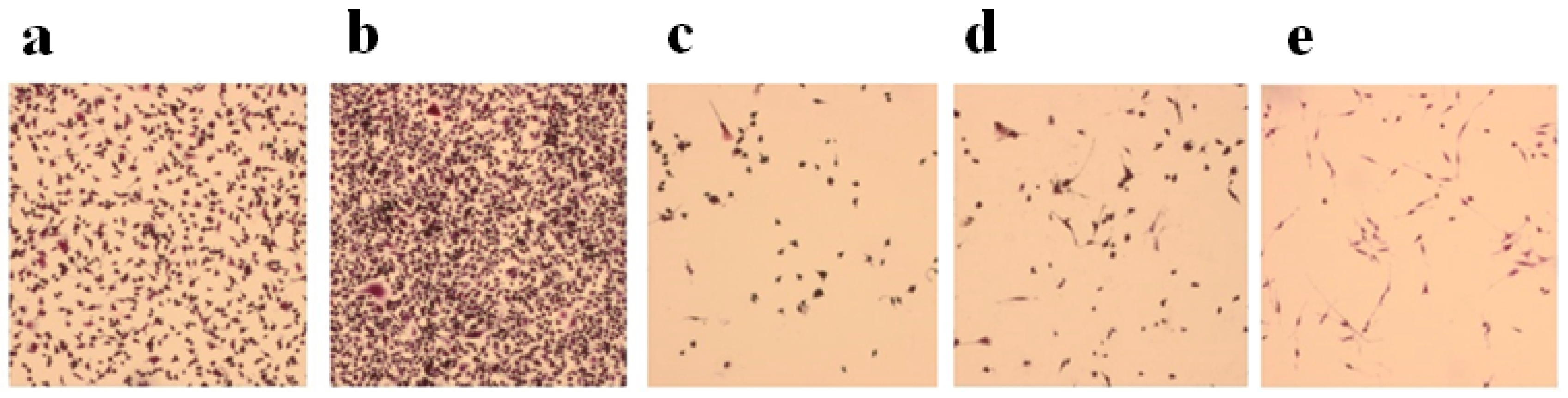 Cancers 11 00206 g002