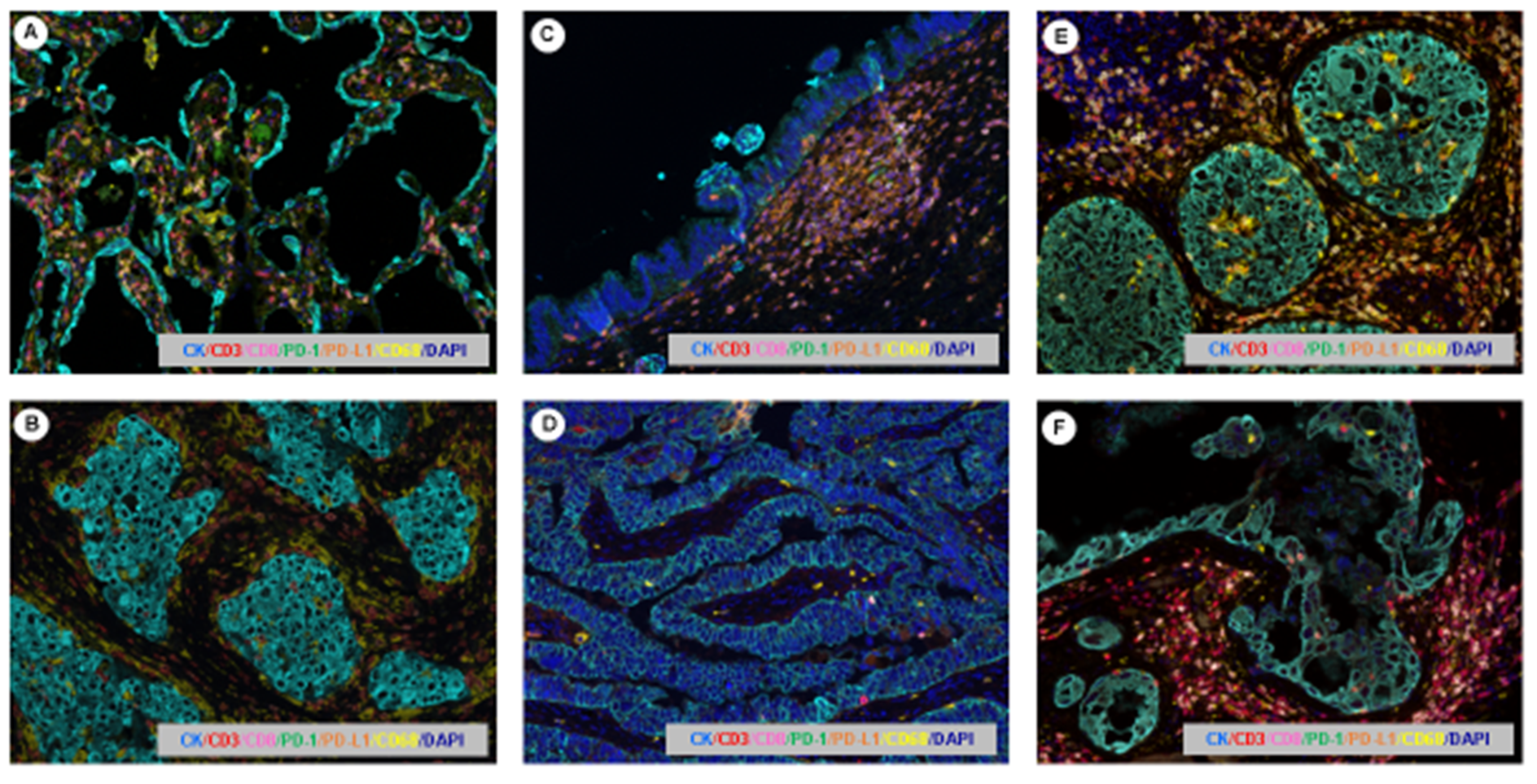 Cancers 11 00247 g005
