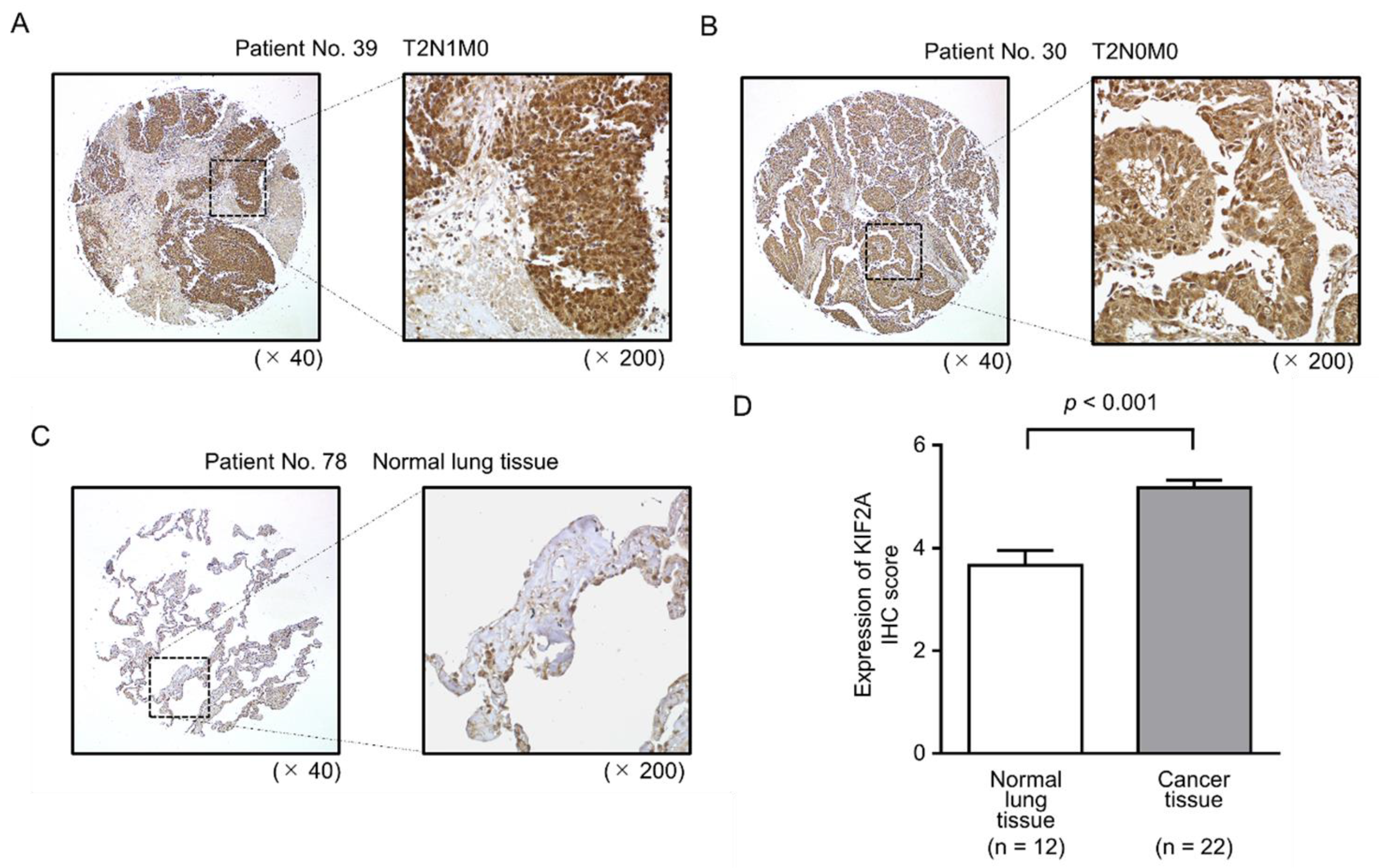 Cancers 11 00258 g007